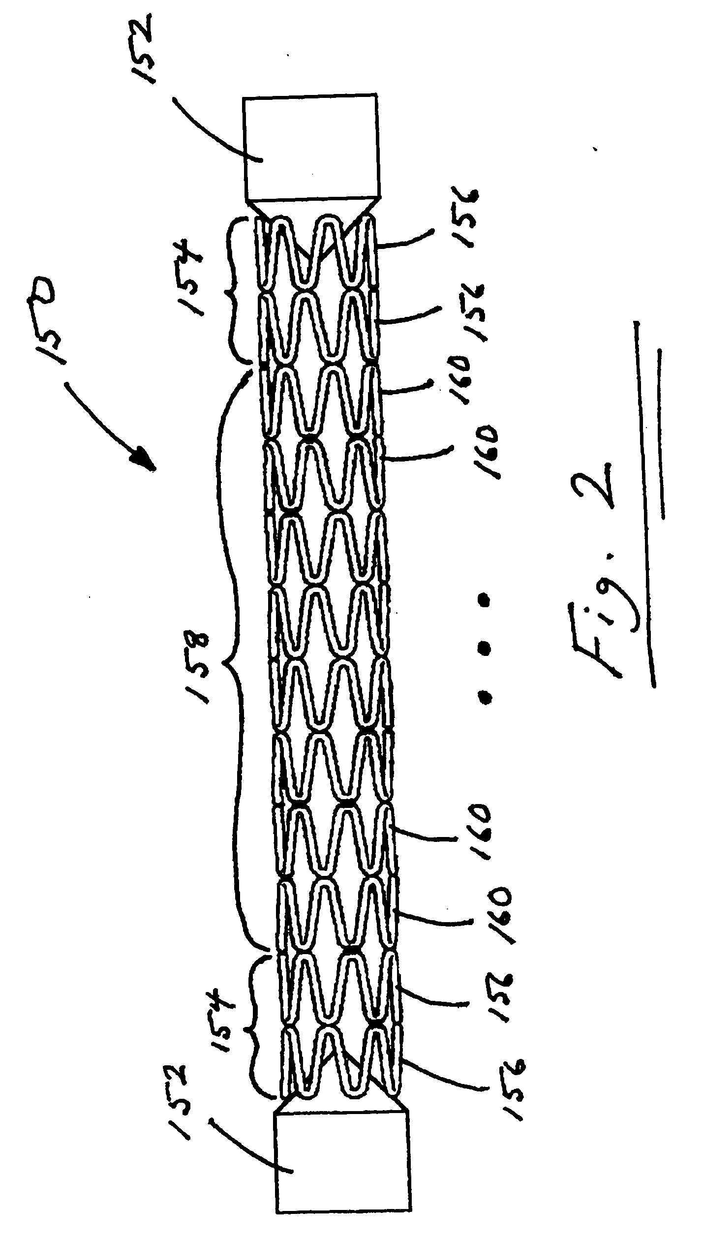 Stent with detachable ends