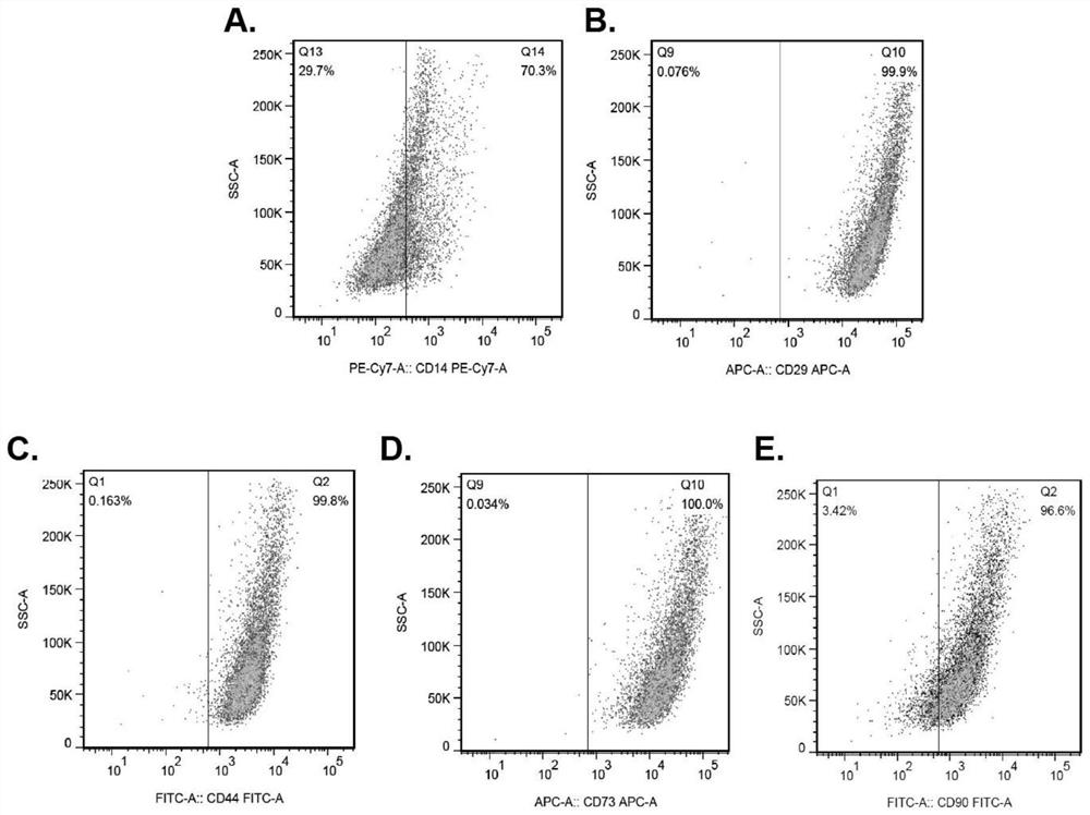 A kind of extracellular vesicle derived from human amniotic mesenchymal stem cells and its application