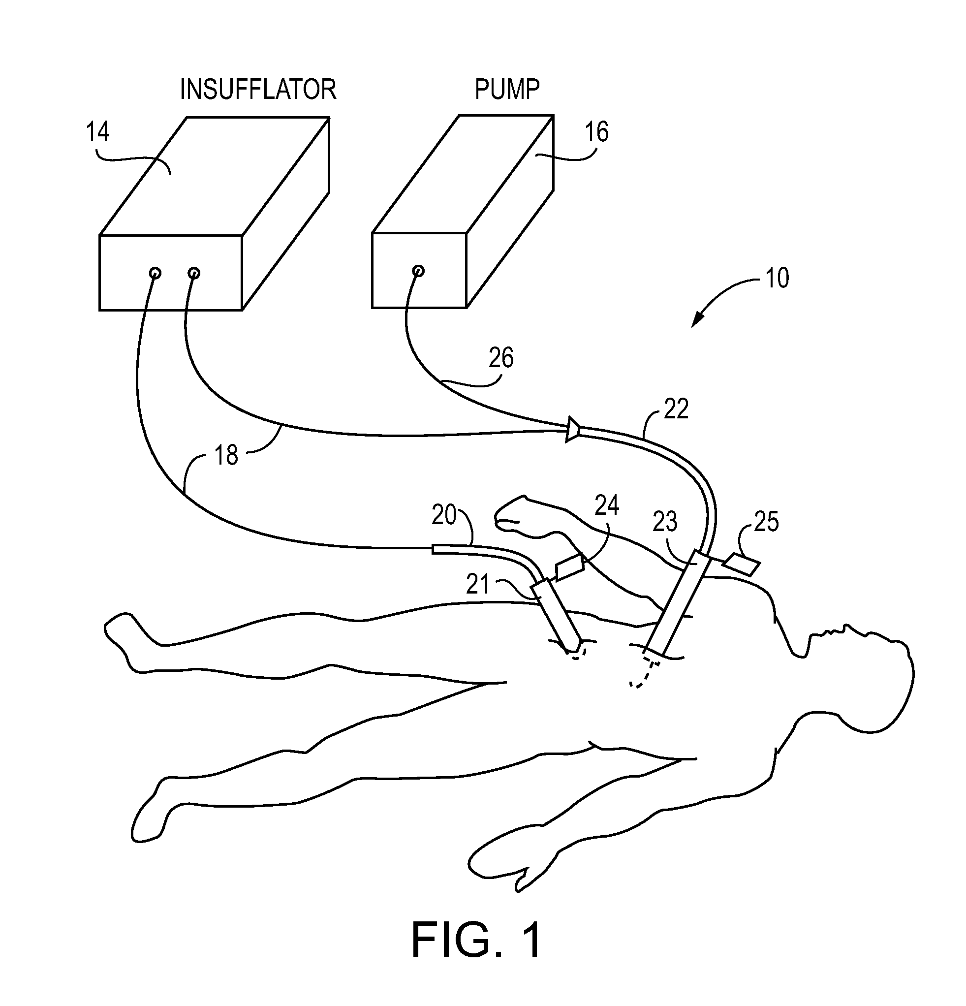 System and method for delivering an Anti-adhesive substance to a body cavity