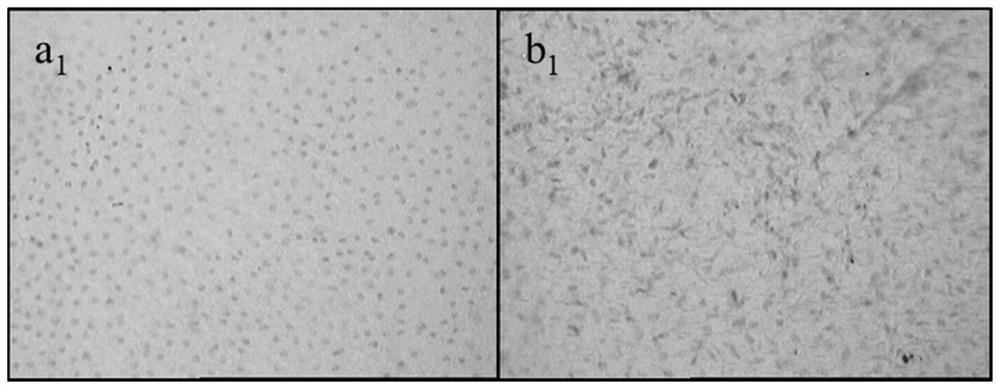 Biological amniotic membrane with complete cell structure and controllable degradation and preparation method thereof