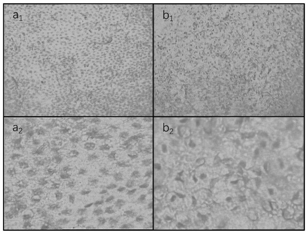 Biological amniotic membrane with complete cell structure and controllable degradation and preparation method thereof