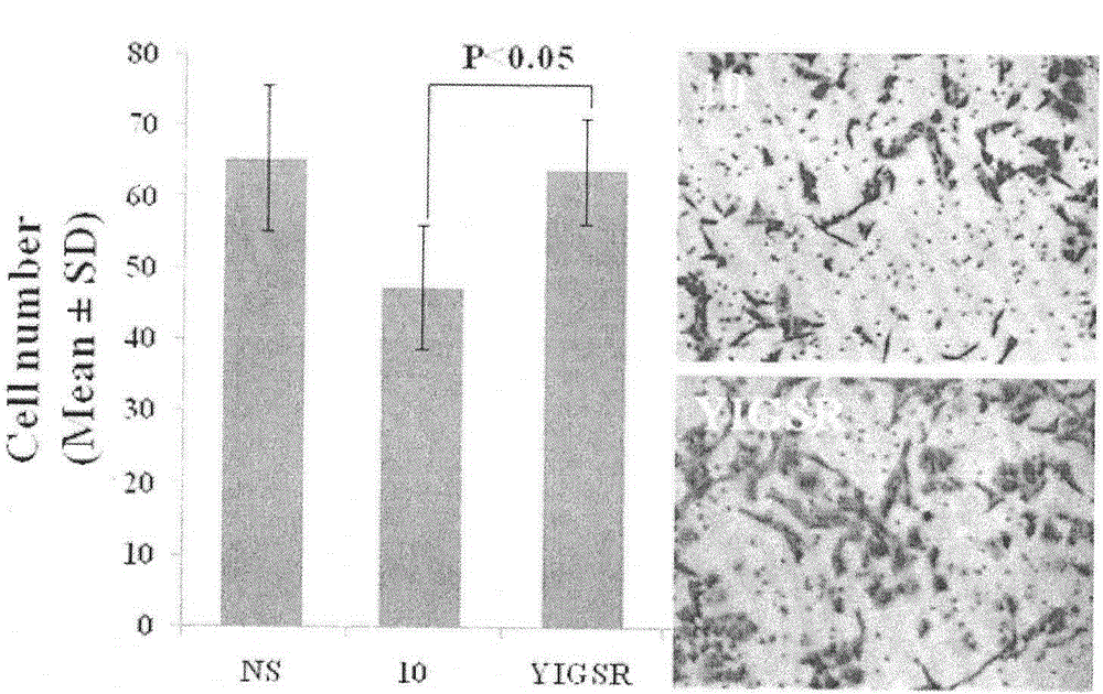 YIGSR modified curcumin, preparation method, biological activity and application thereof