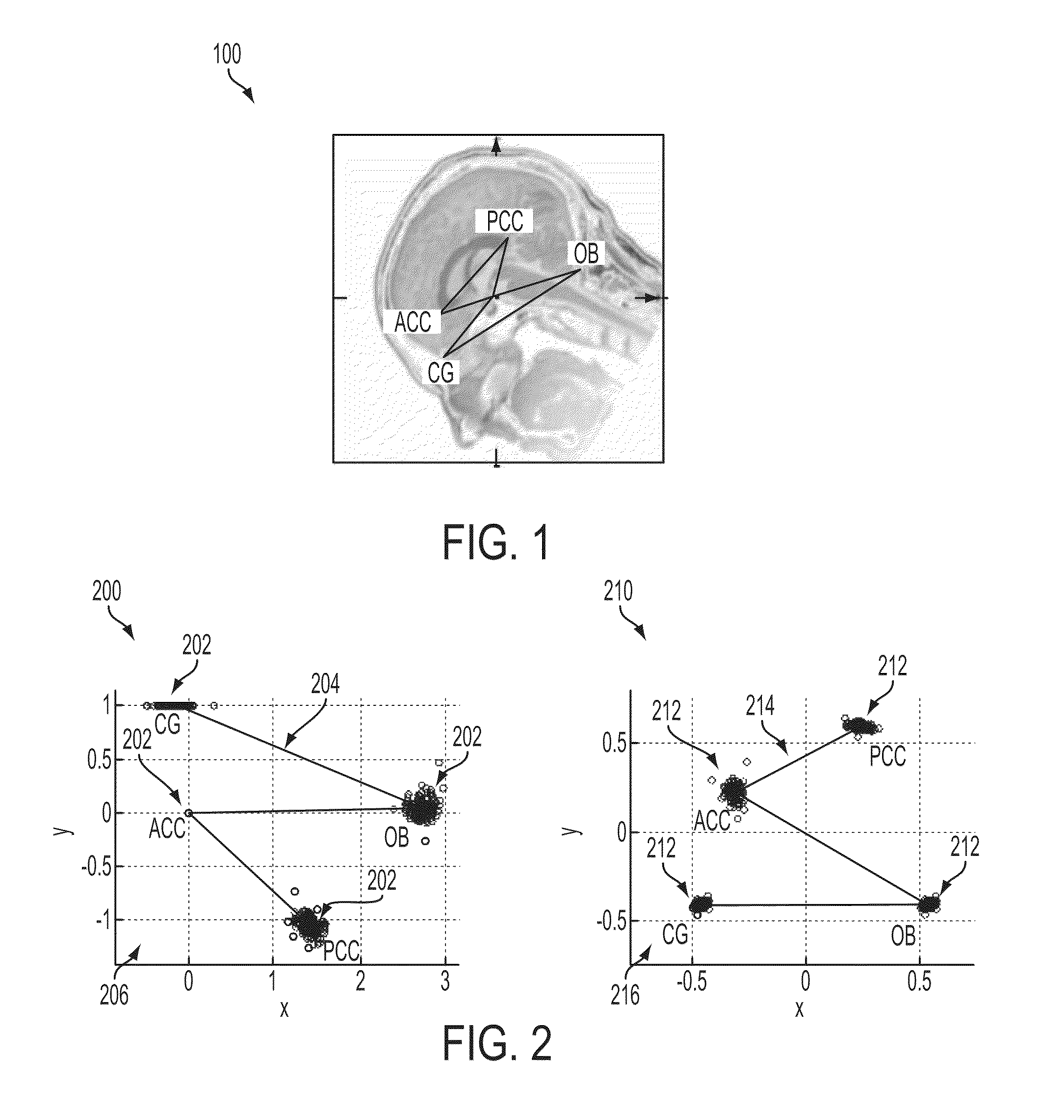 Method and system for anatomic landmark detection using constrained marginal space learning and geometric inference