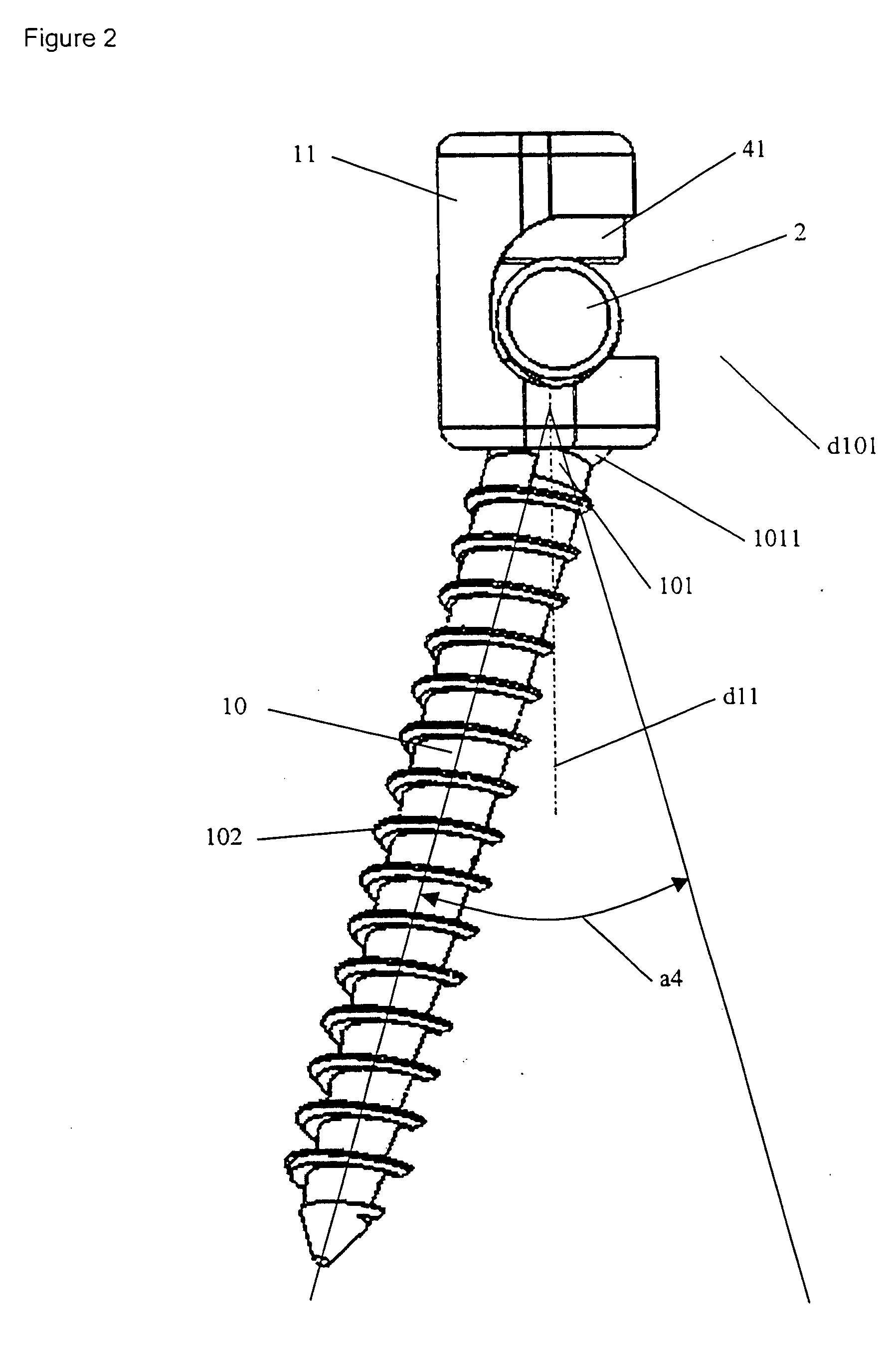 Implant for osseous anchoring with polyaxial head