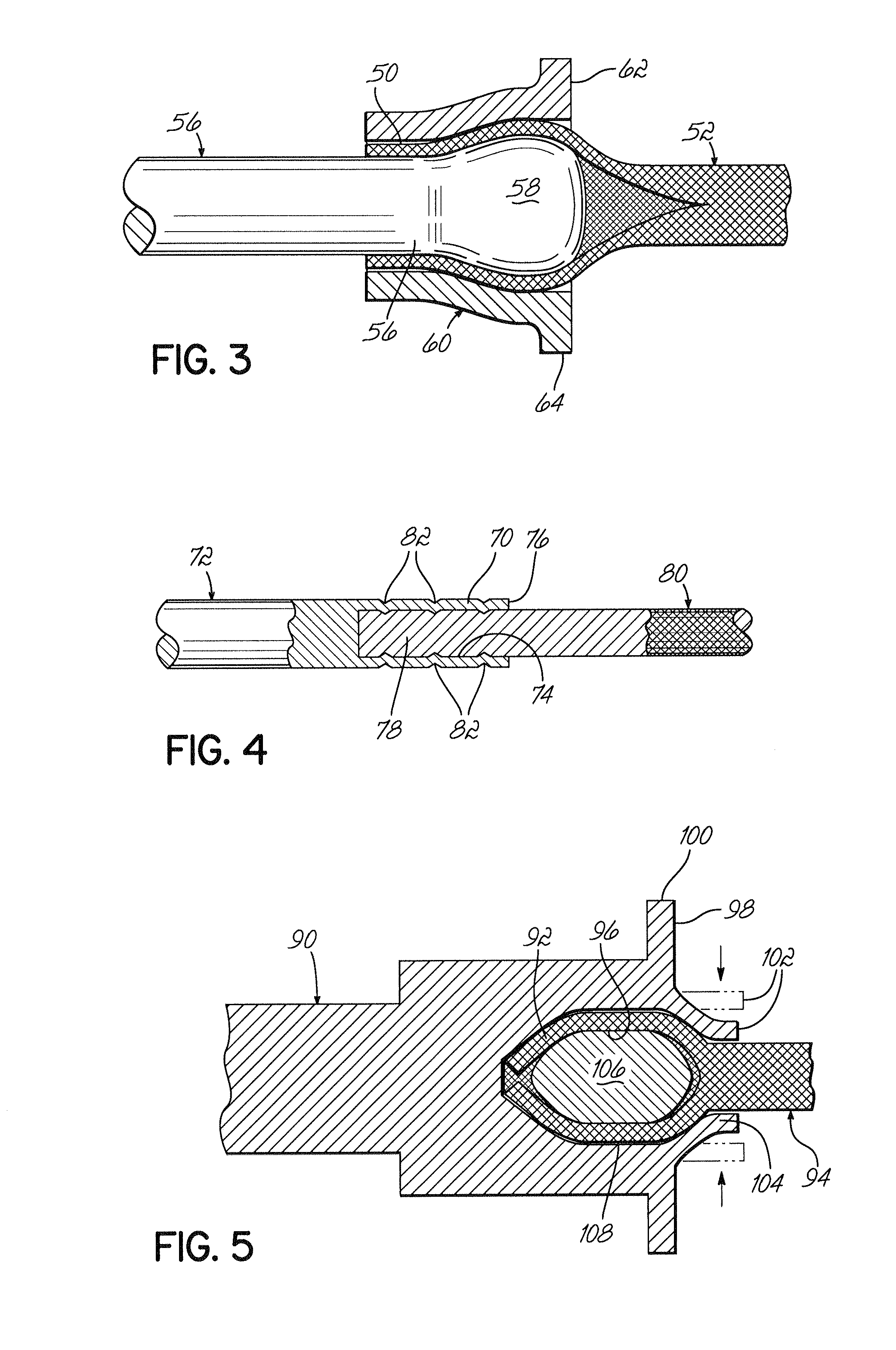 Spinal stabilization system with rigid and flexible elements