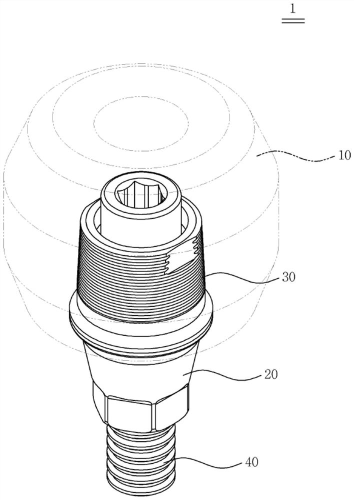 Dental implant structure having dental prosthesis breakage prevention housing and separation jig therefor