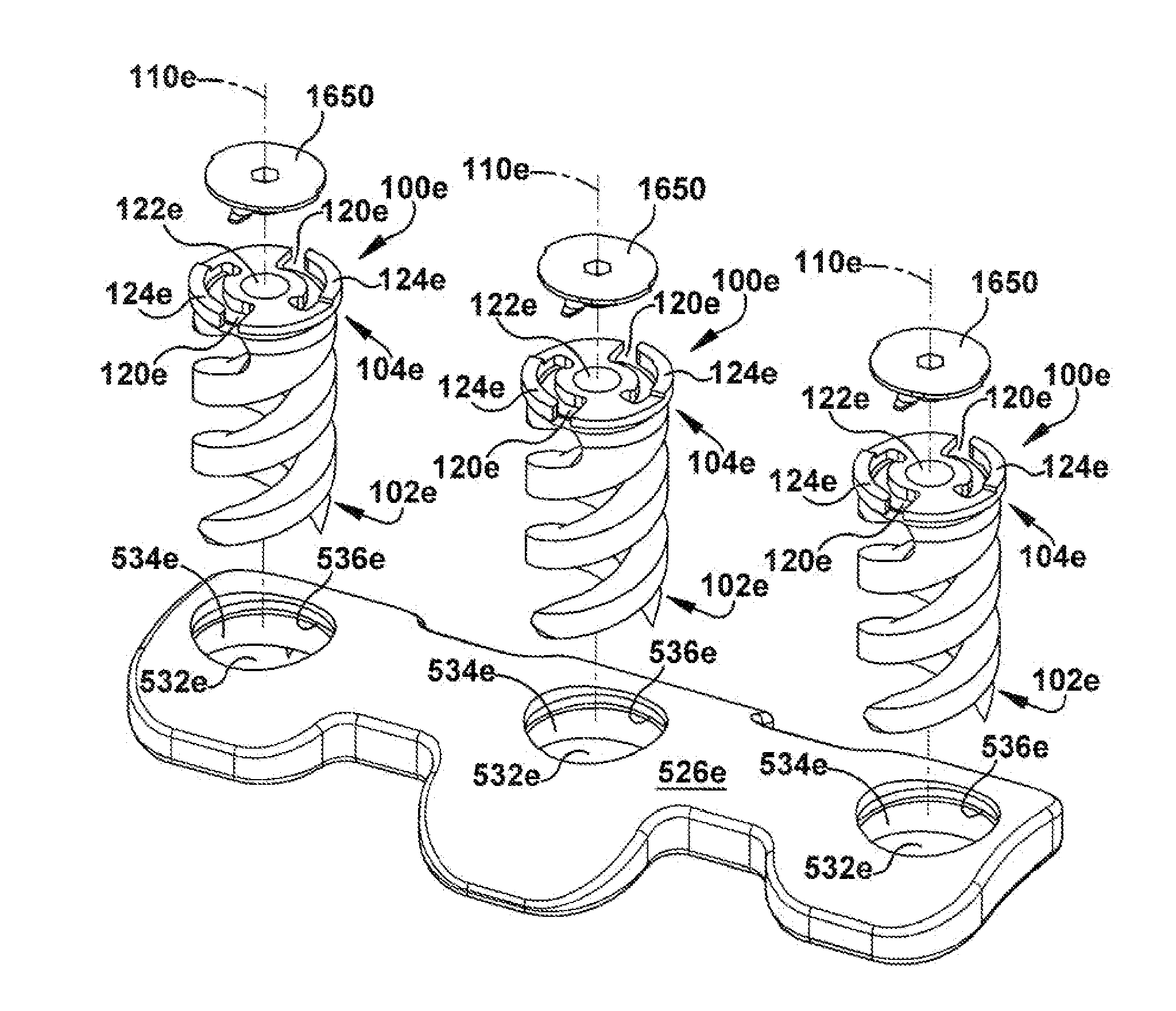 Apparatus and method for body tissue fixation