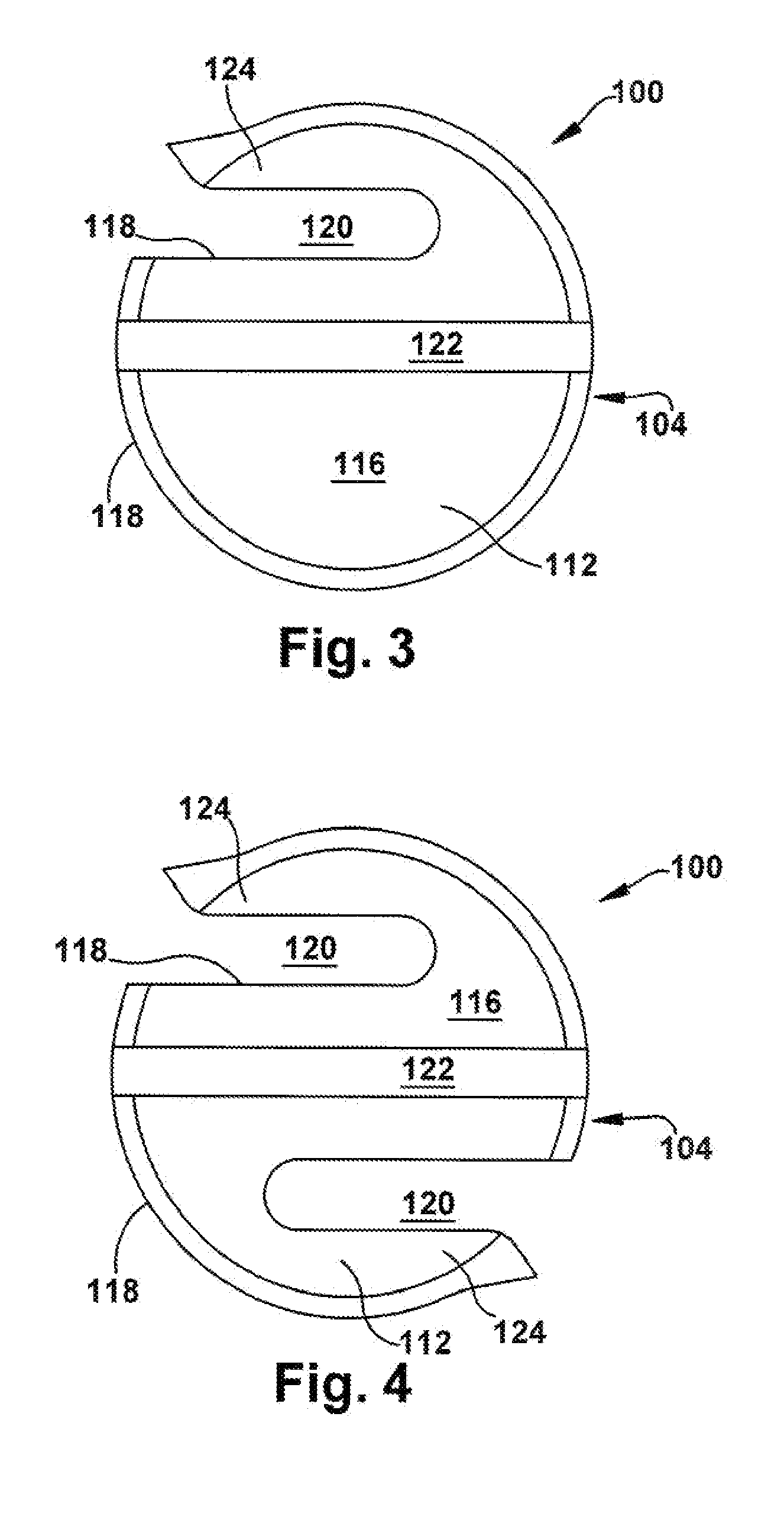 Apparatus and method for body tissue fixation