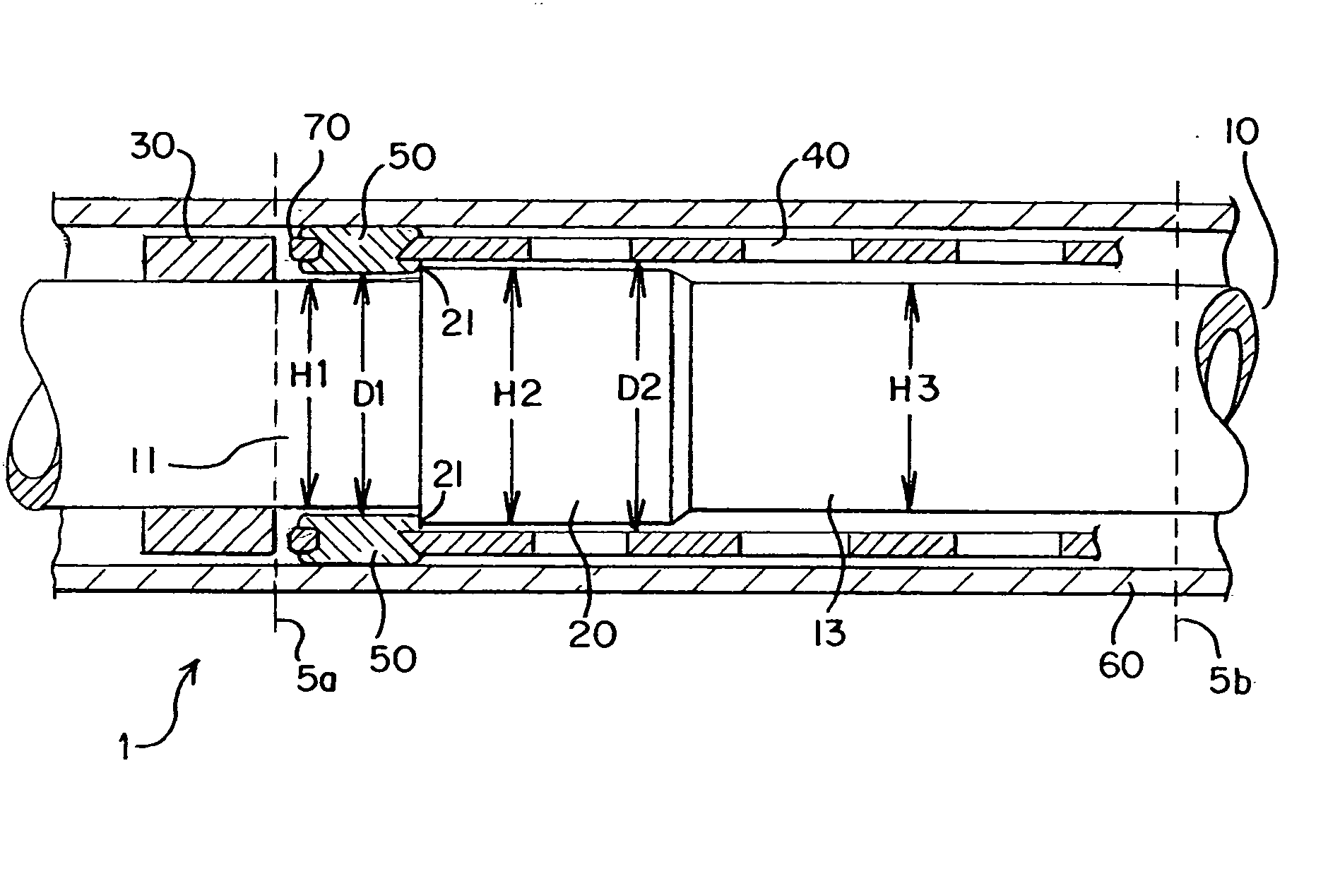 Stent delivery system allowing controlled release of a stent