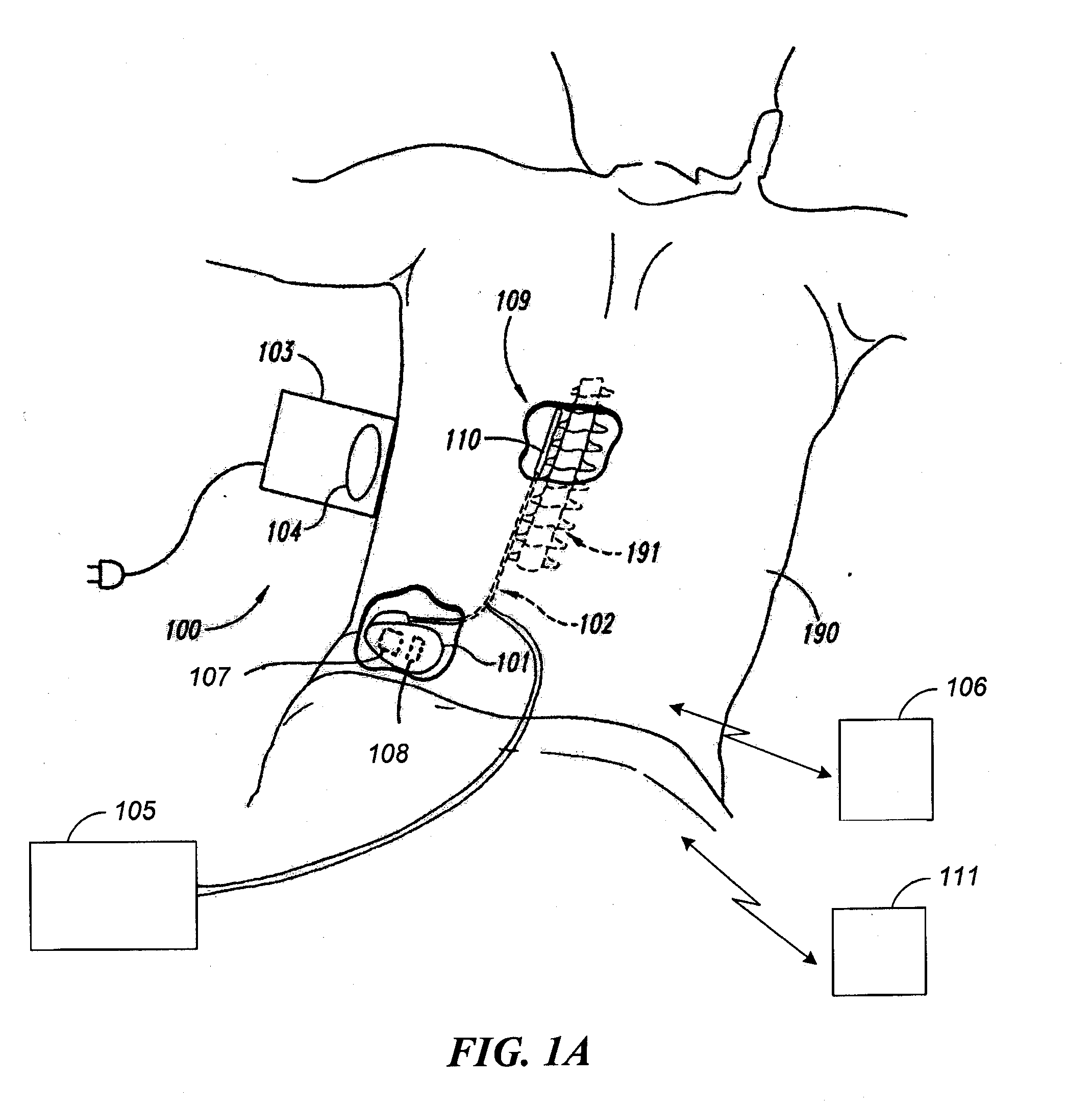 Systems and methods for adjusting electrical therapy based on impedance changes