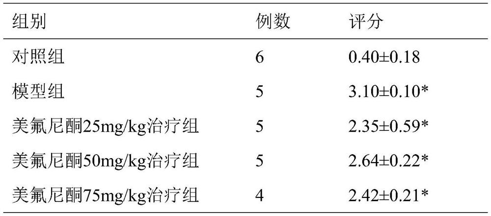 Application of meflunidone in preparation of medicine for treating acute kidney injury