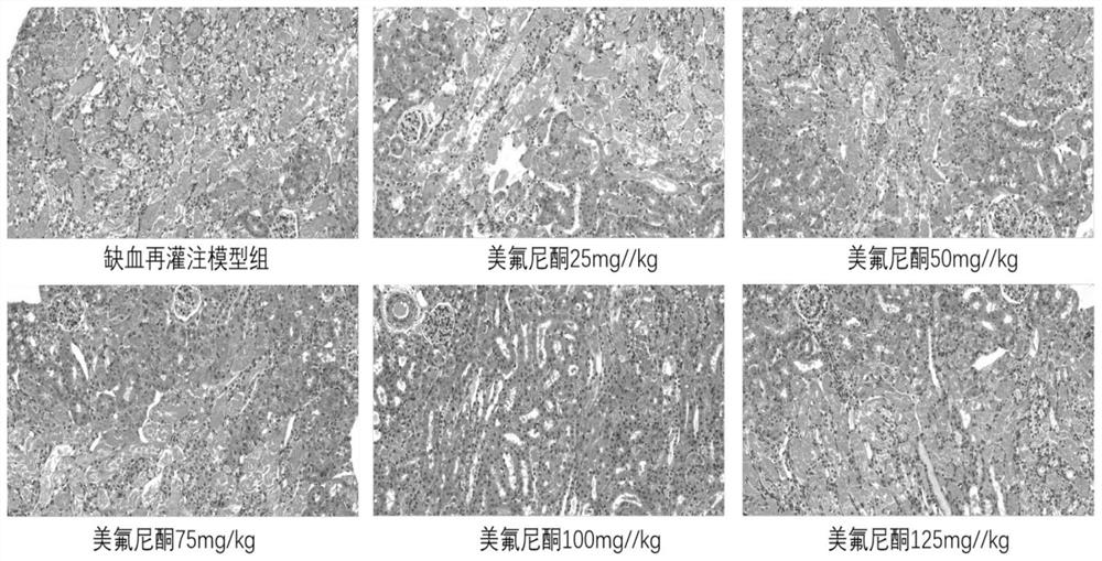 Application of meflunidone in preparation of medicine for treating acute kidney injury