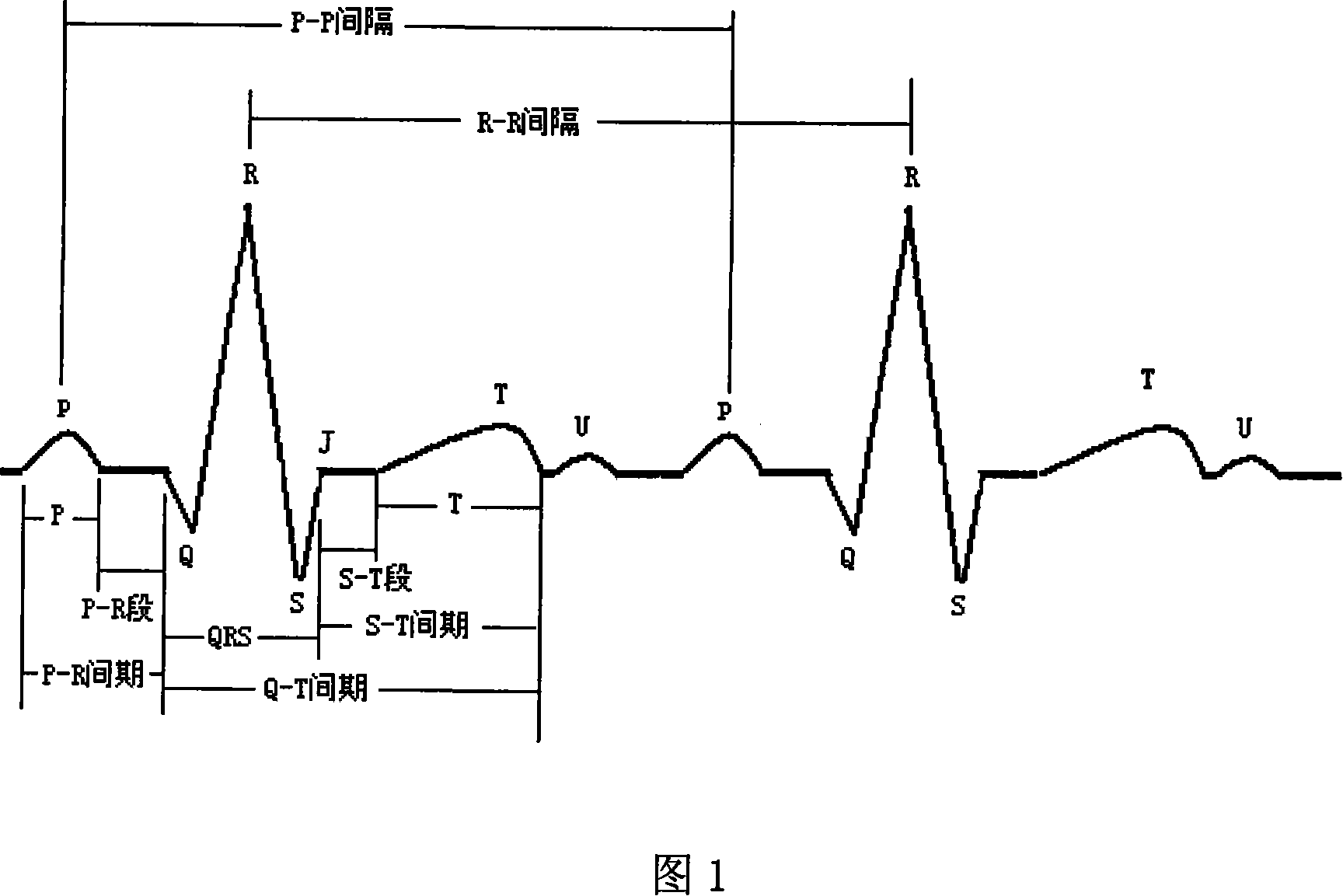 Method for measuring electrocardiogram