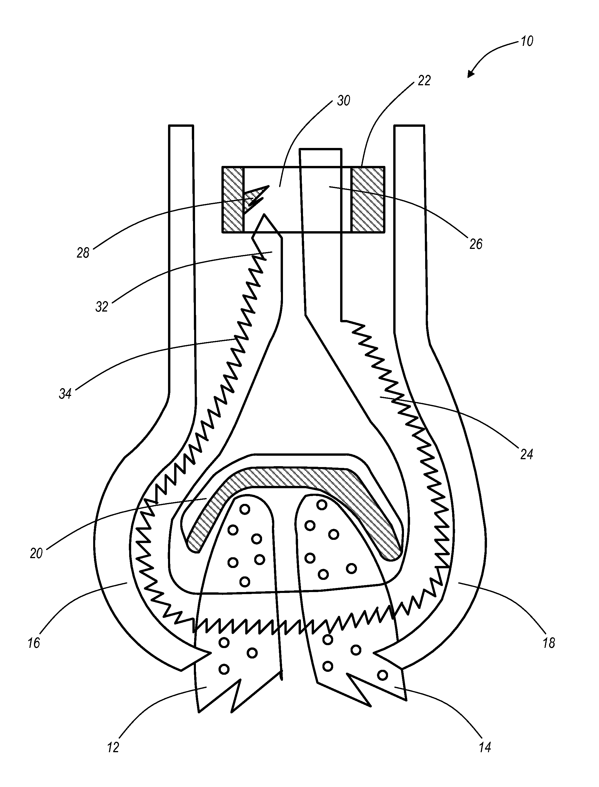 Surgical systems and methods for joint fixation