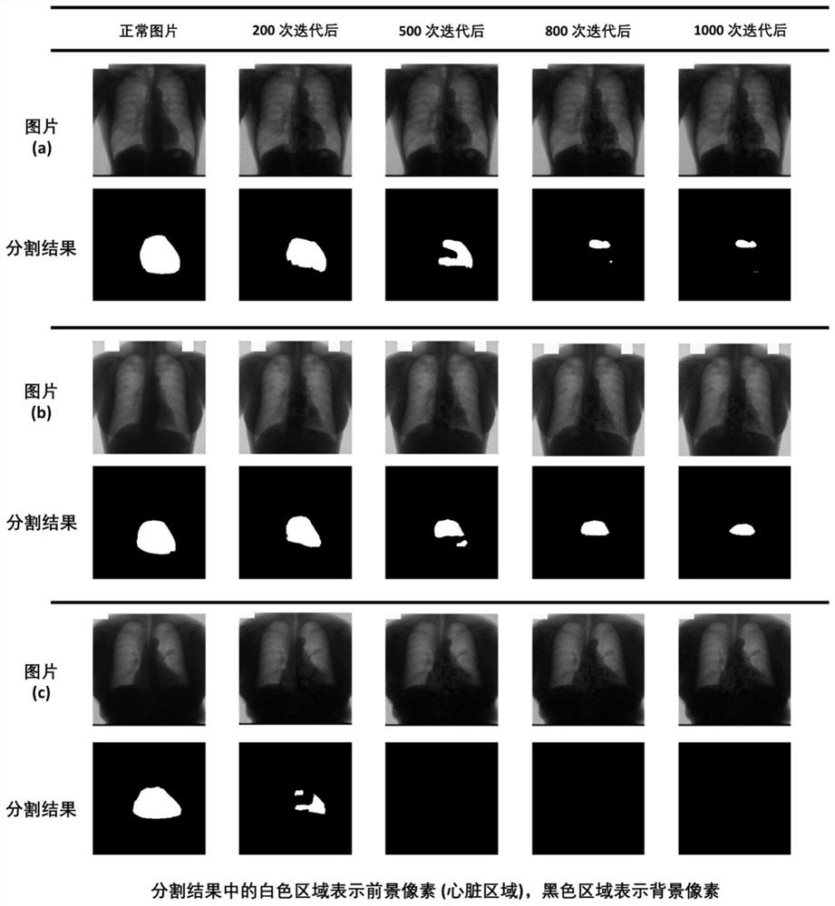 Black box attack method of medical image segmentation neural network based on query