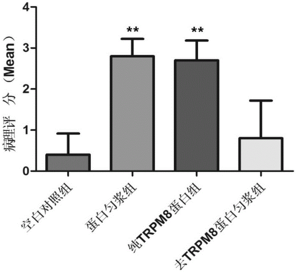 TRPM8 protein and related polypeptide fragment and new application of antibody thereof