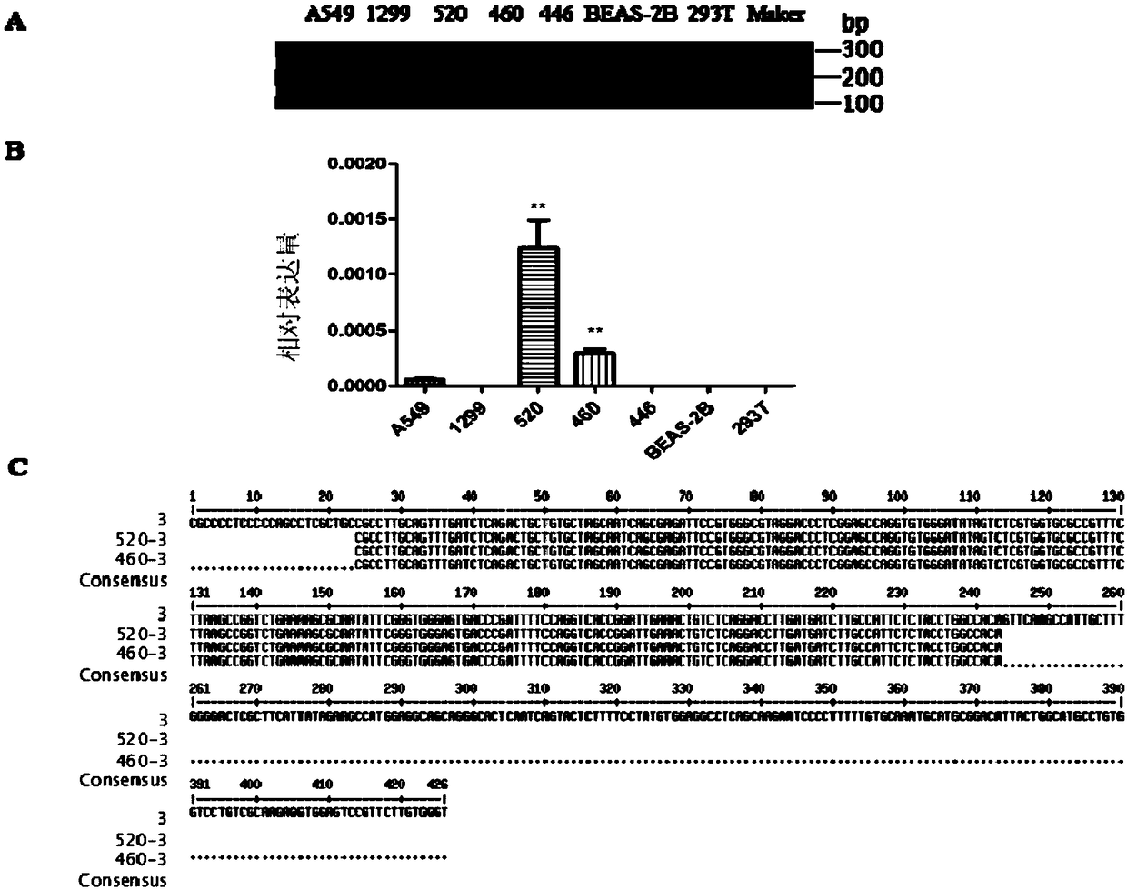 Retrotransposition gene L1-FGGY and application thereof as marker of lung squamous cell carcinoma