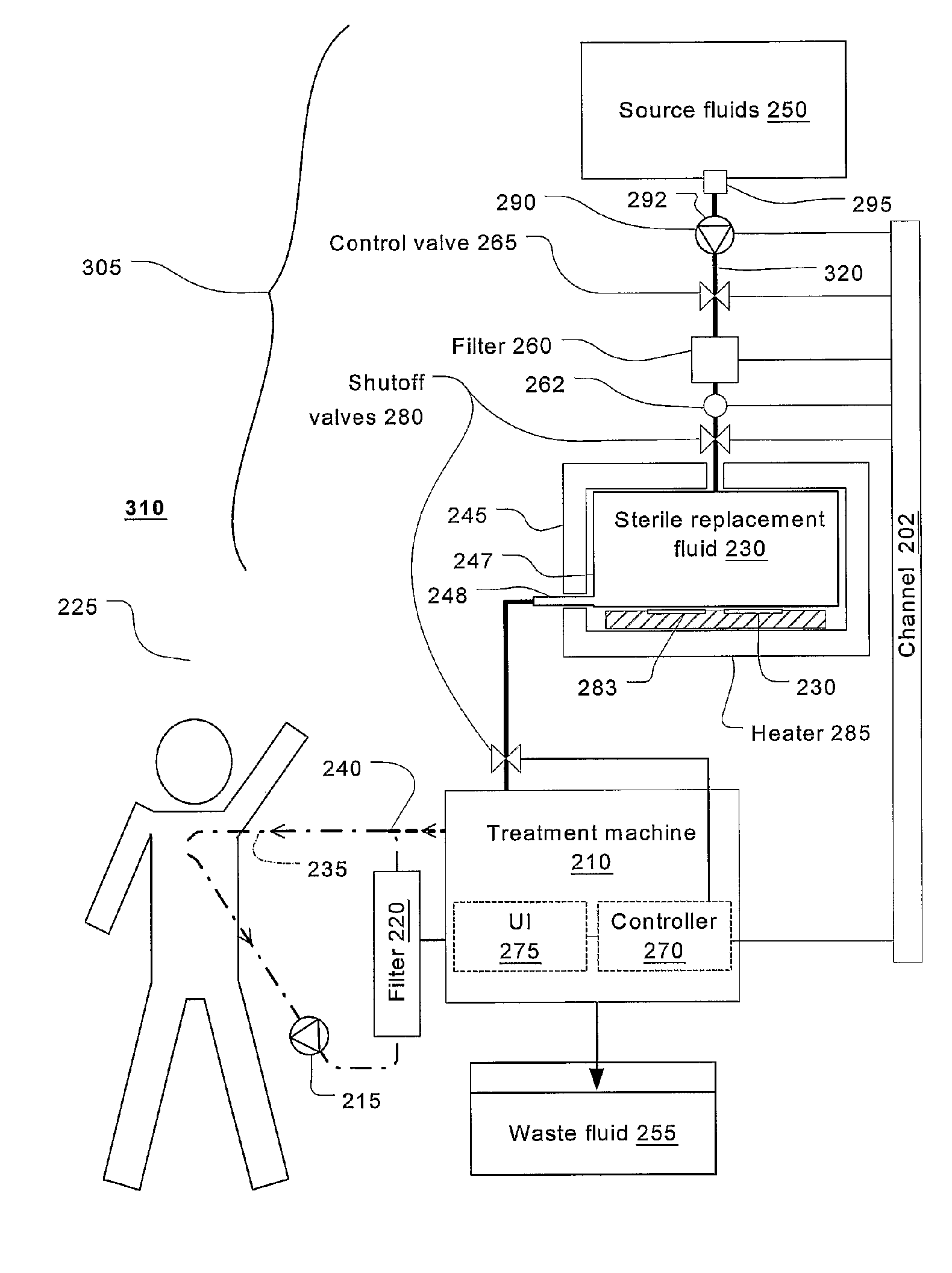 Batch filtration system for preparation of sterile fluid for renal replacement therapy