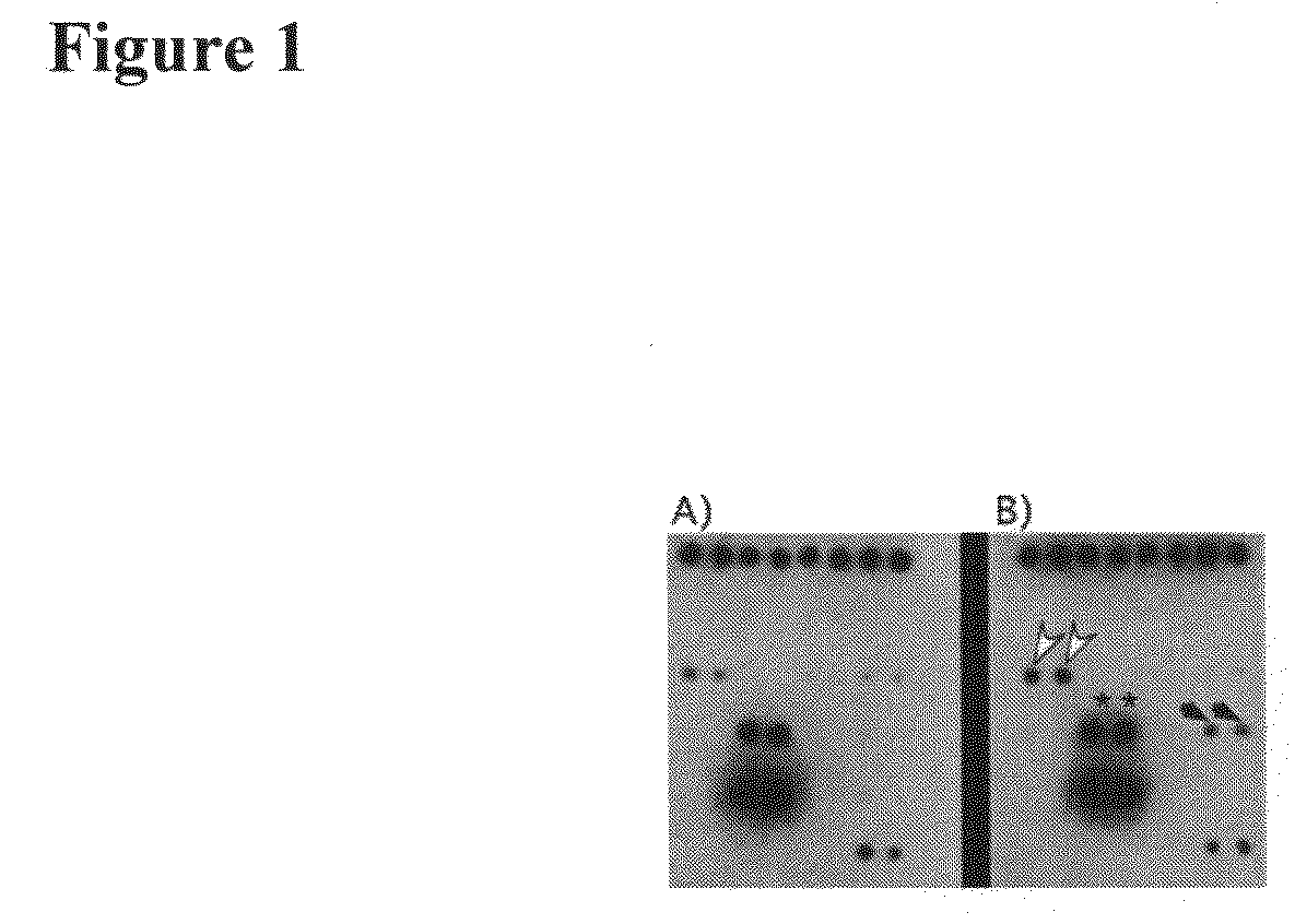 Methods and compositions for the treatment and diagnosis of vascular inflammatory disorders or endothelial cell disorders