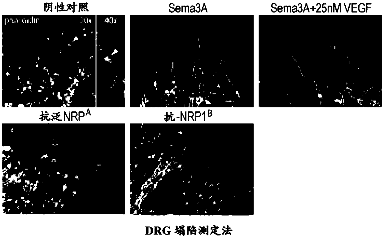 Crystal structure of neuropilin fragment in complex with neuropilin antibody