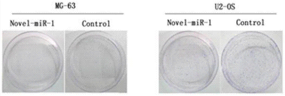 Small-molecular novel-miR-1 and osteosarcoma medicine