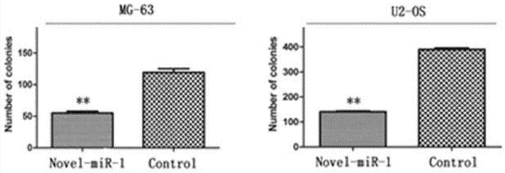 Small-molecular novel-miR-1 and osteosarcoma medicine