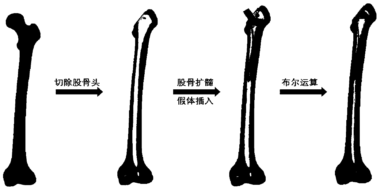 Method for designing femoral stem prosthesis
