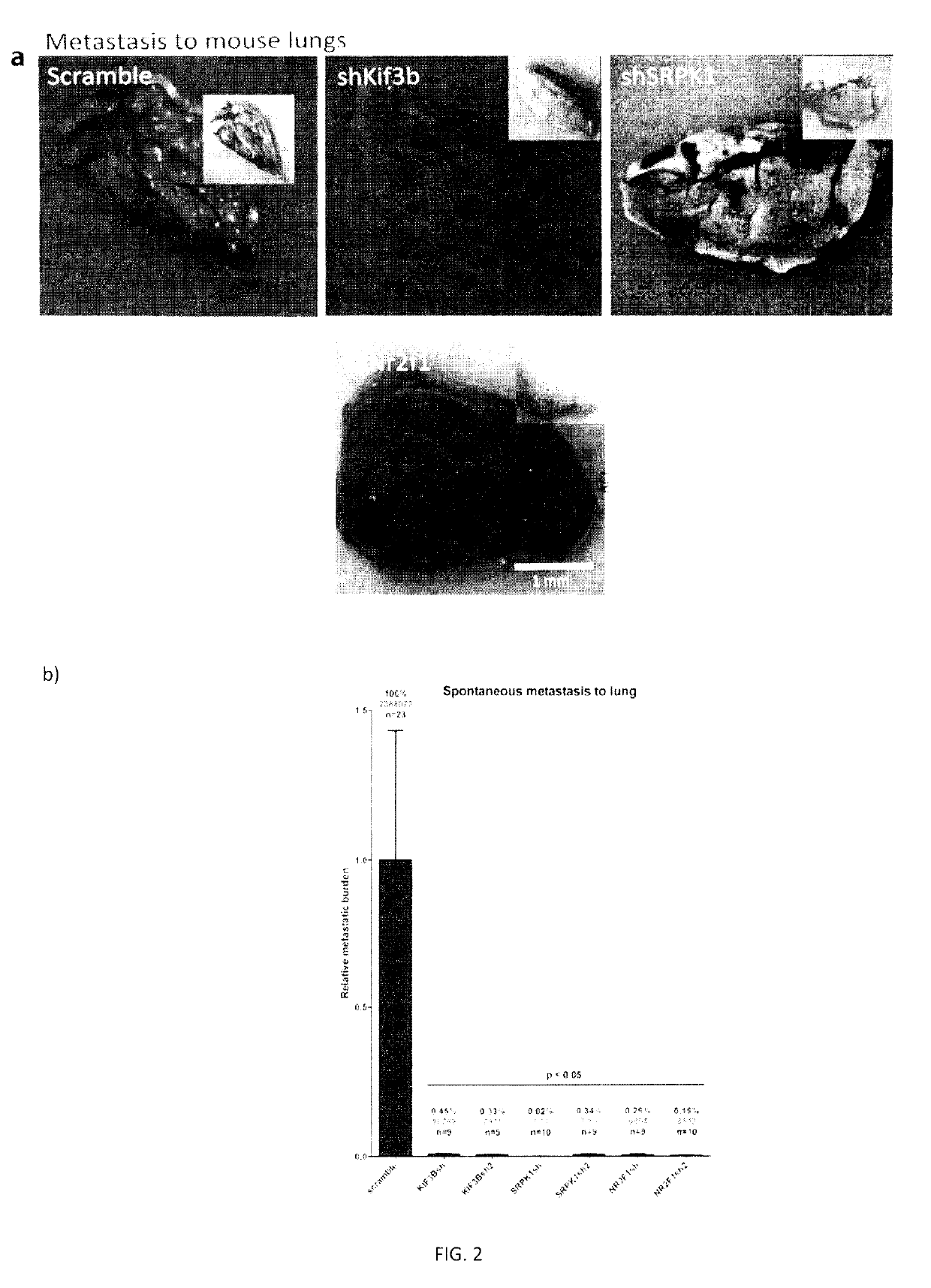 Methods for diagnosing and treating metastatic cancer