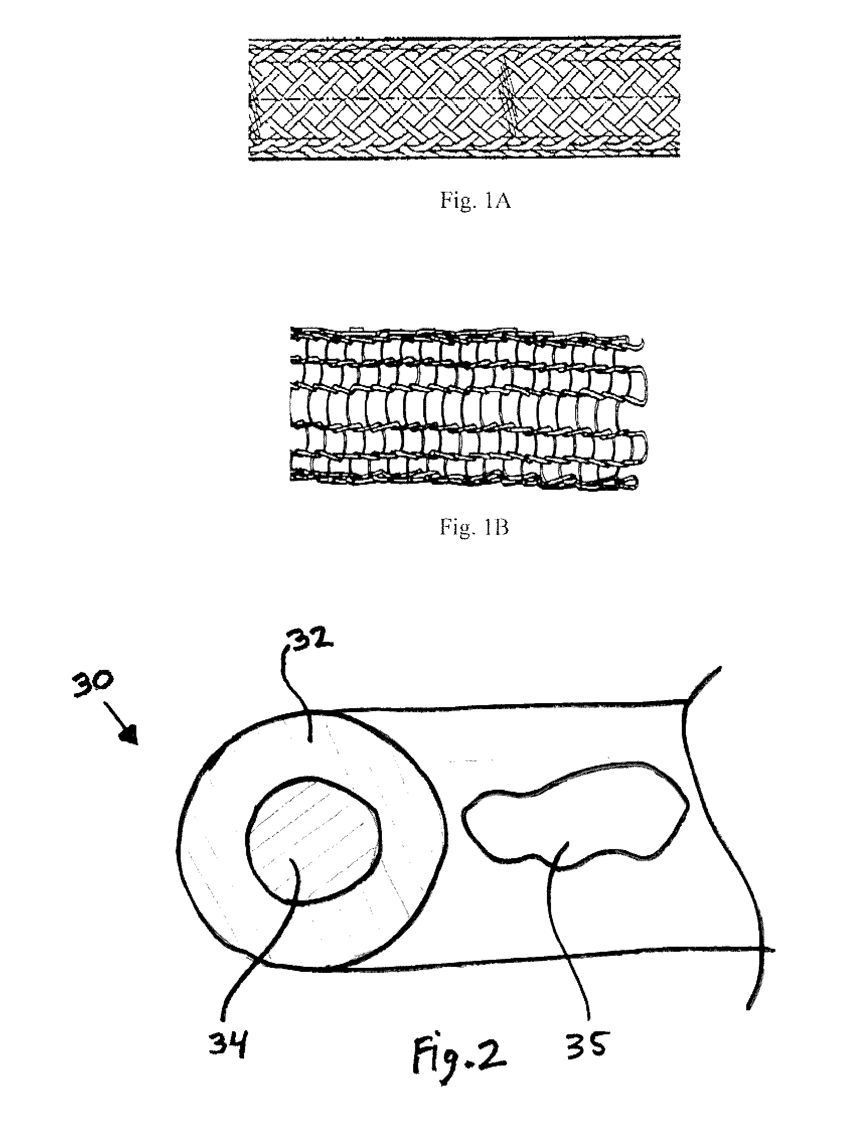 Biodegradable composite wire for medical devices