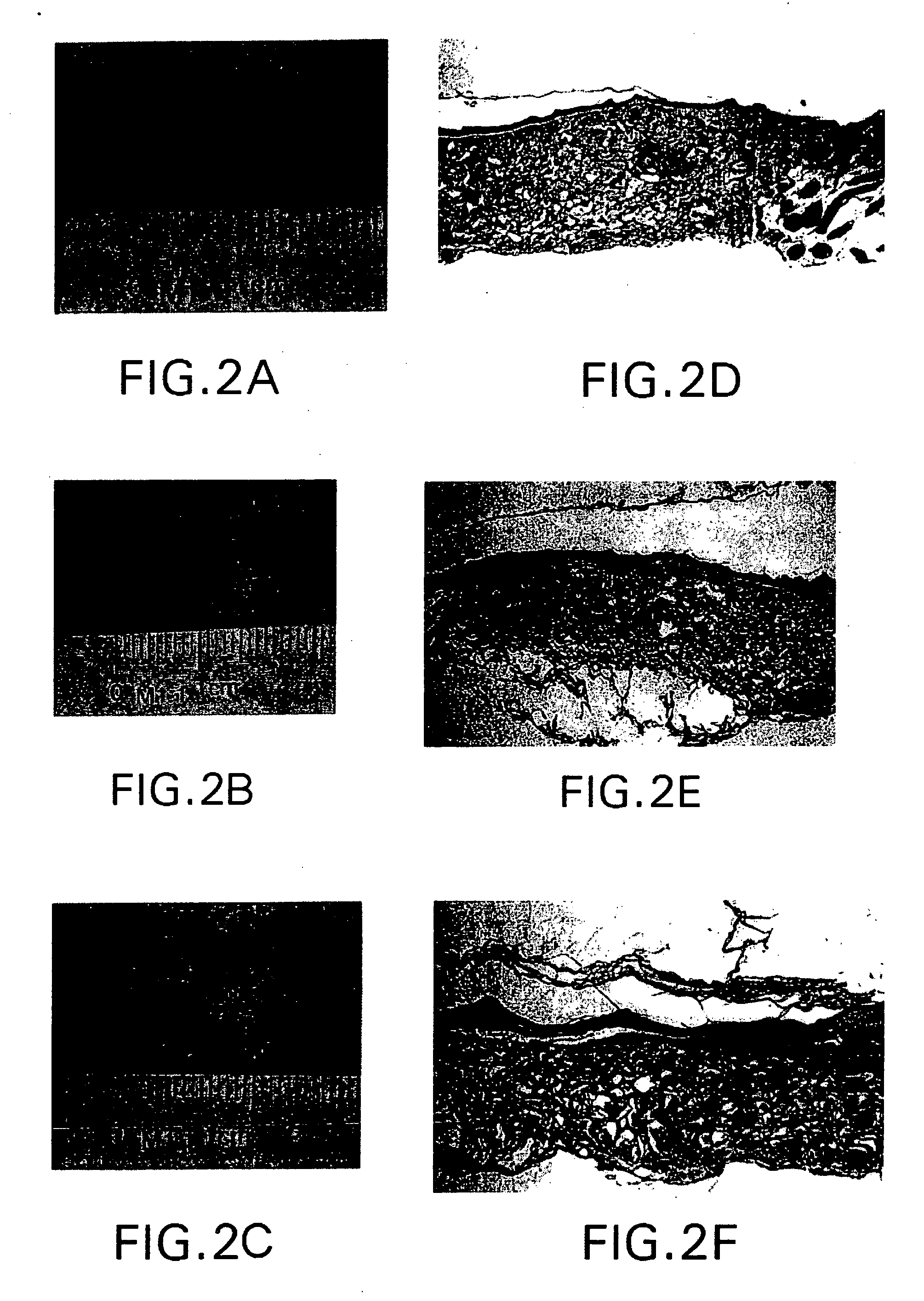 Fibrin cell supports and method of use thereof