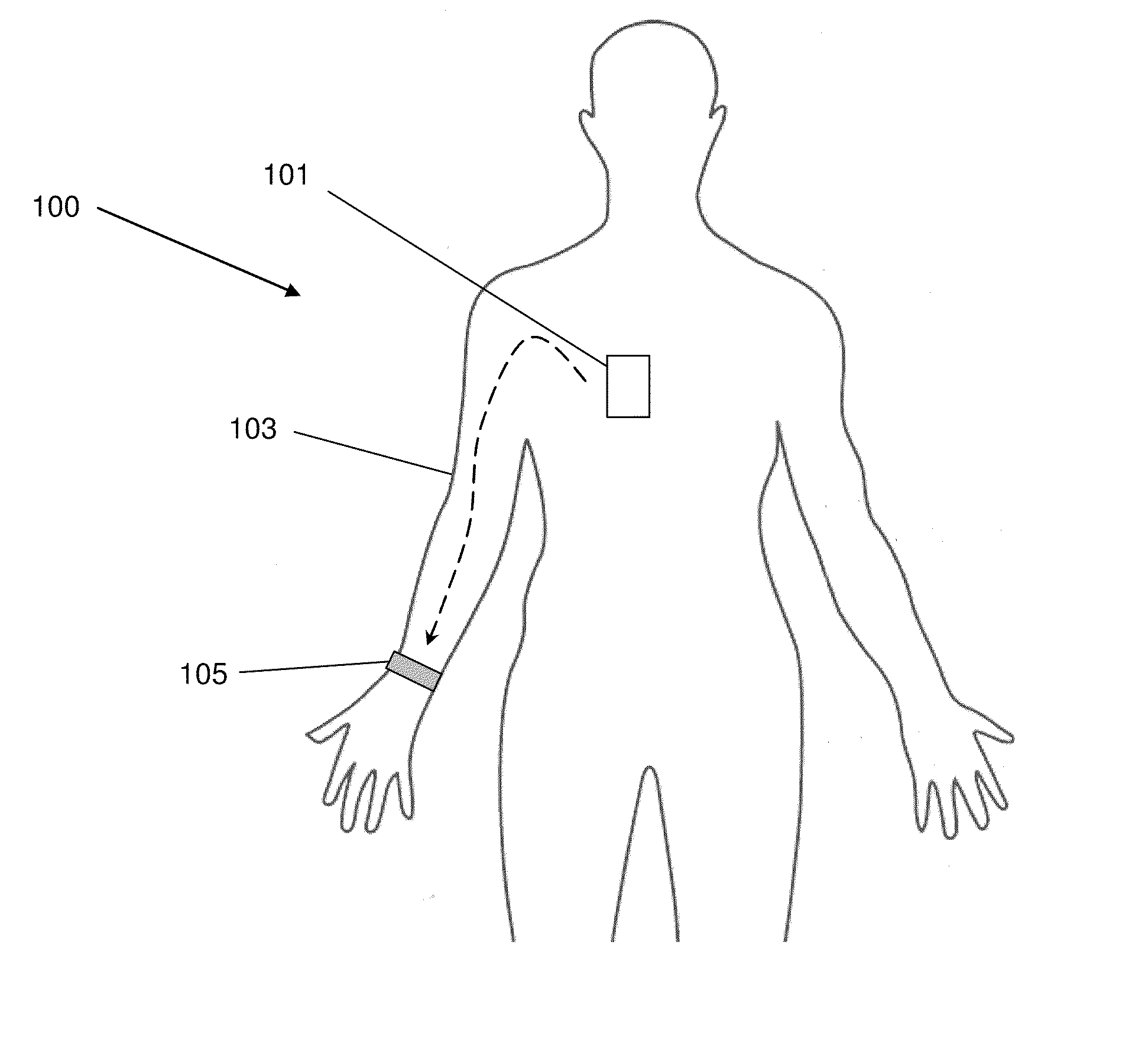 System and method for intra-body communication