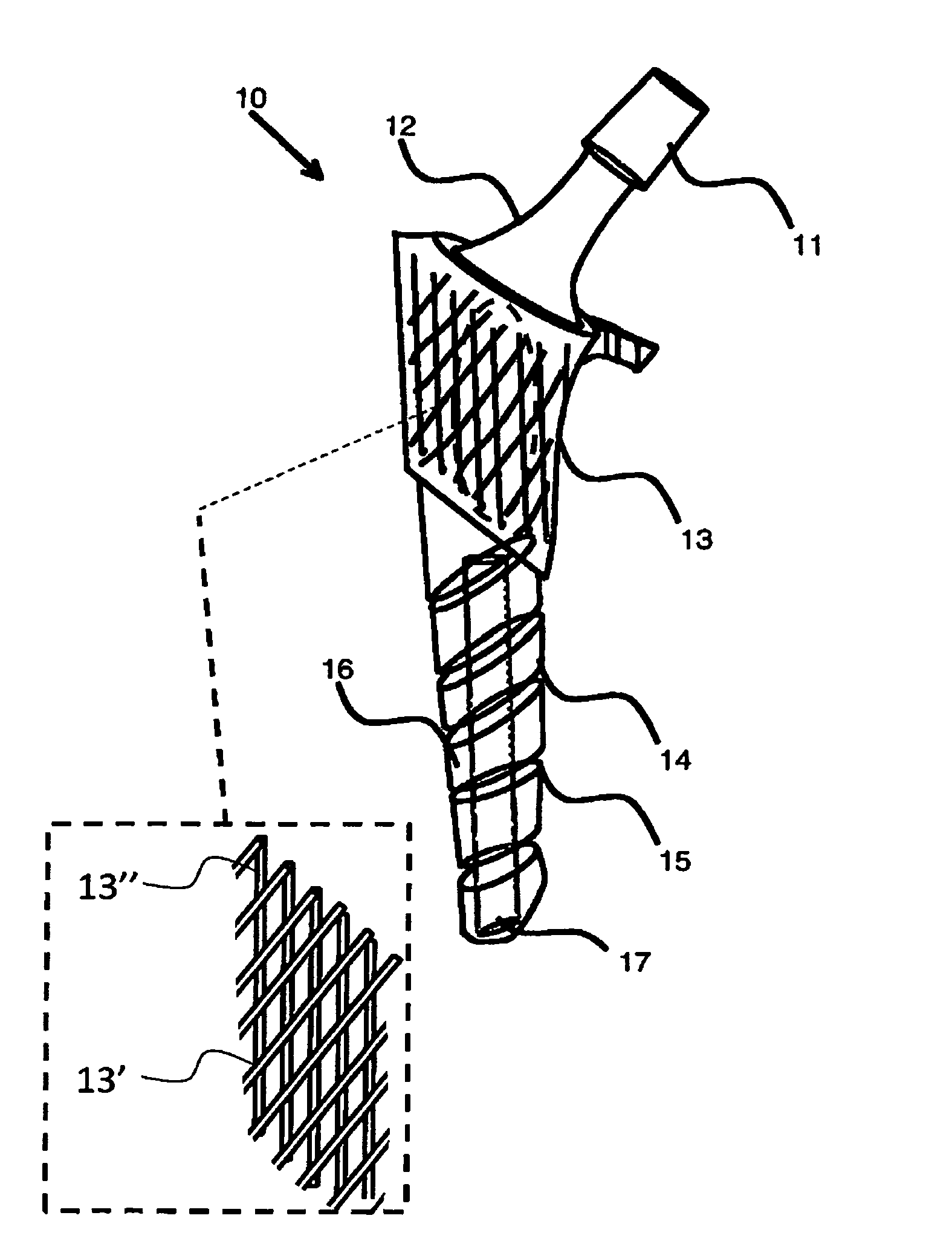 Load bearing implants