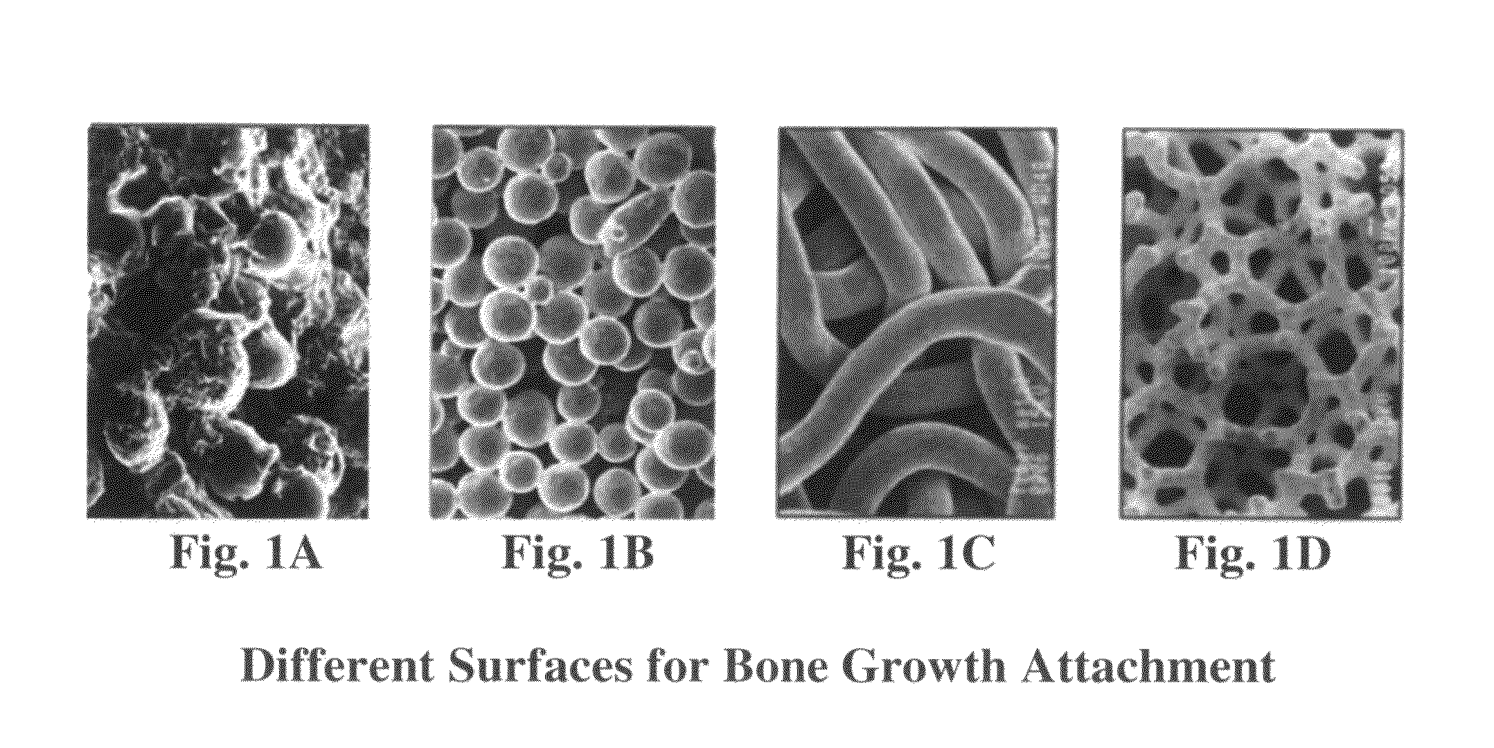 Load bearing implants