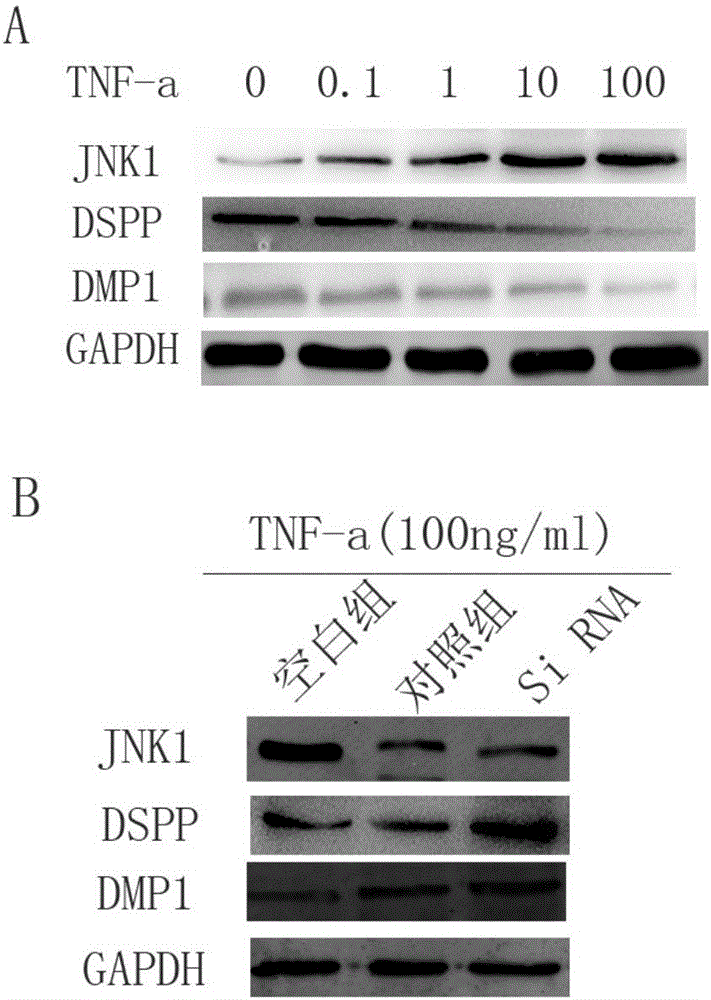 Human JNK1 (c-Jun N-terminal kinase) gene targeting small interfering RNA (ribonucleic acid) and application thereof