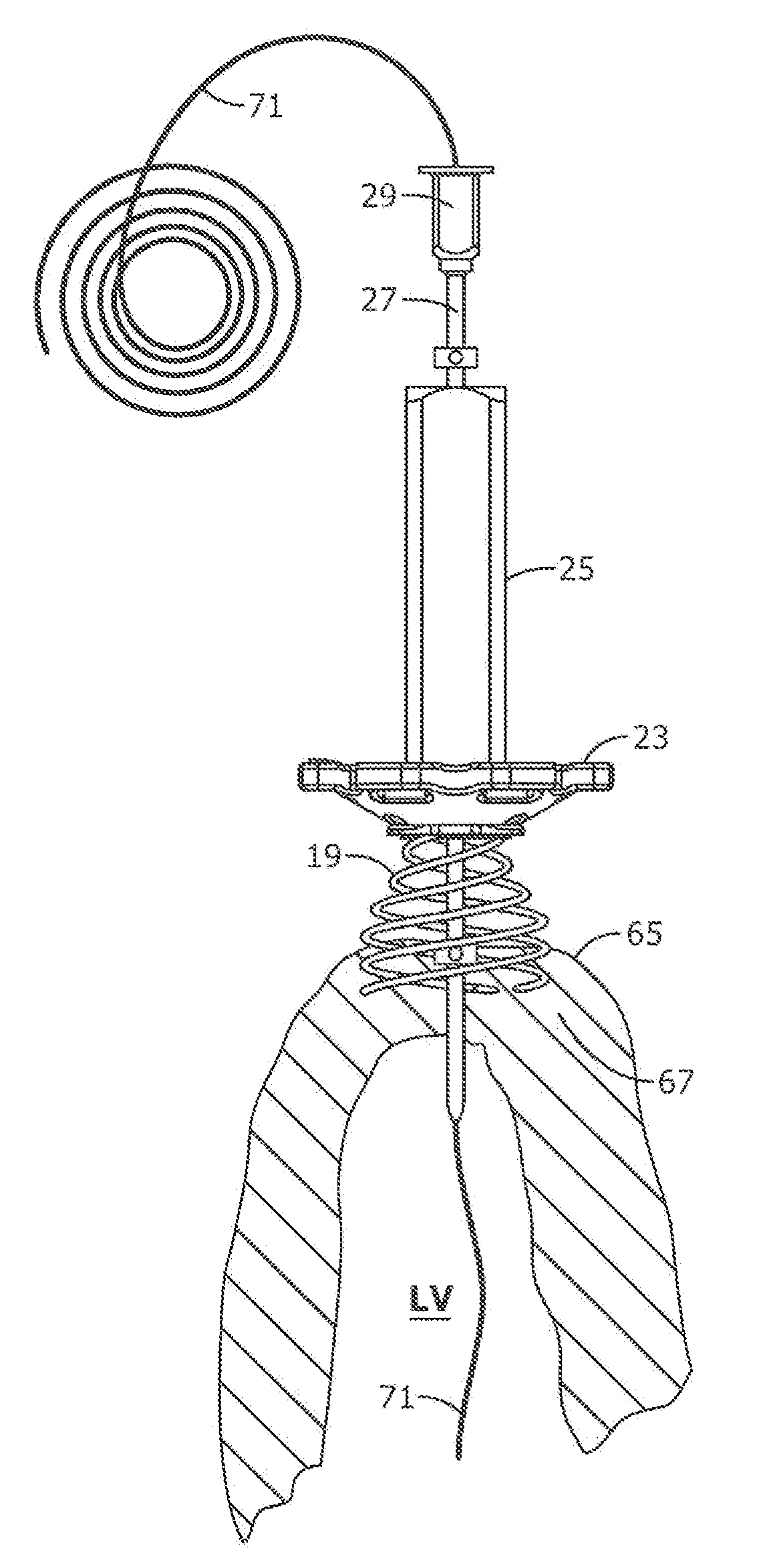 Device for creating temporary access and then closure