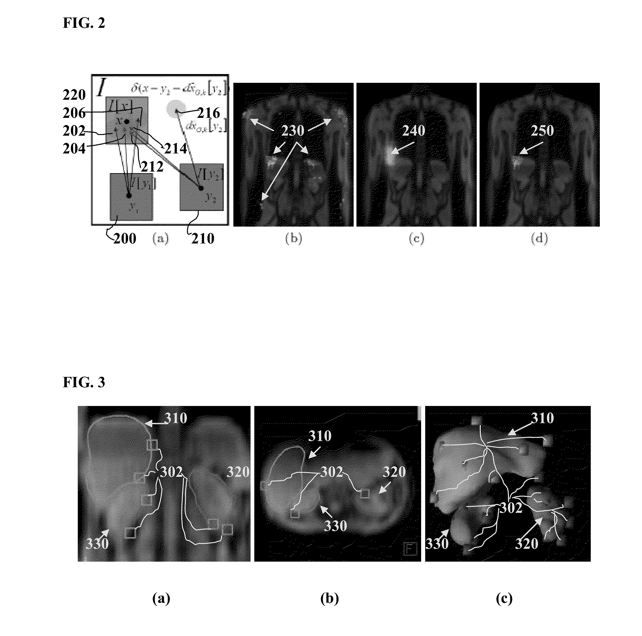 Method and system for joint multi-organ segmentation in medical image data using local and global context