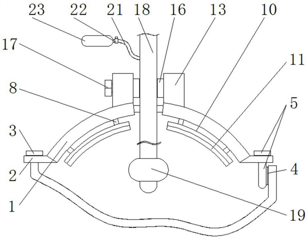 Trachea cannula fixator