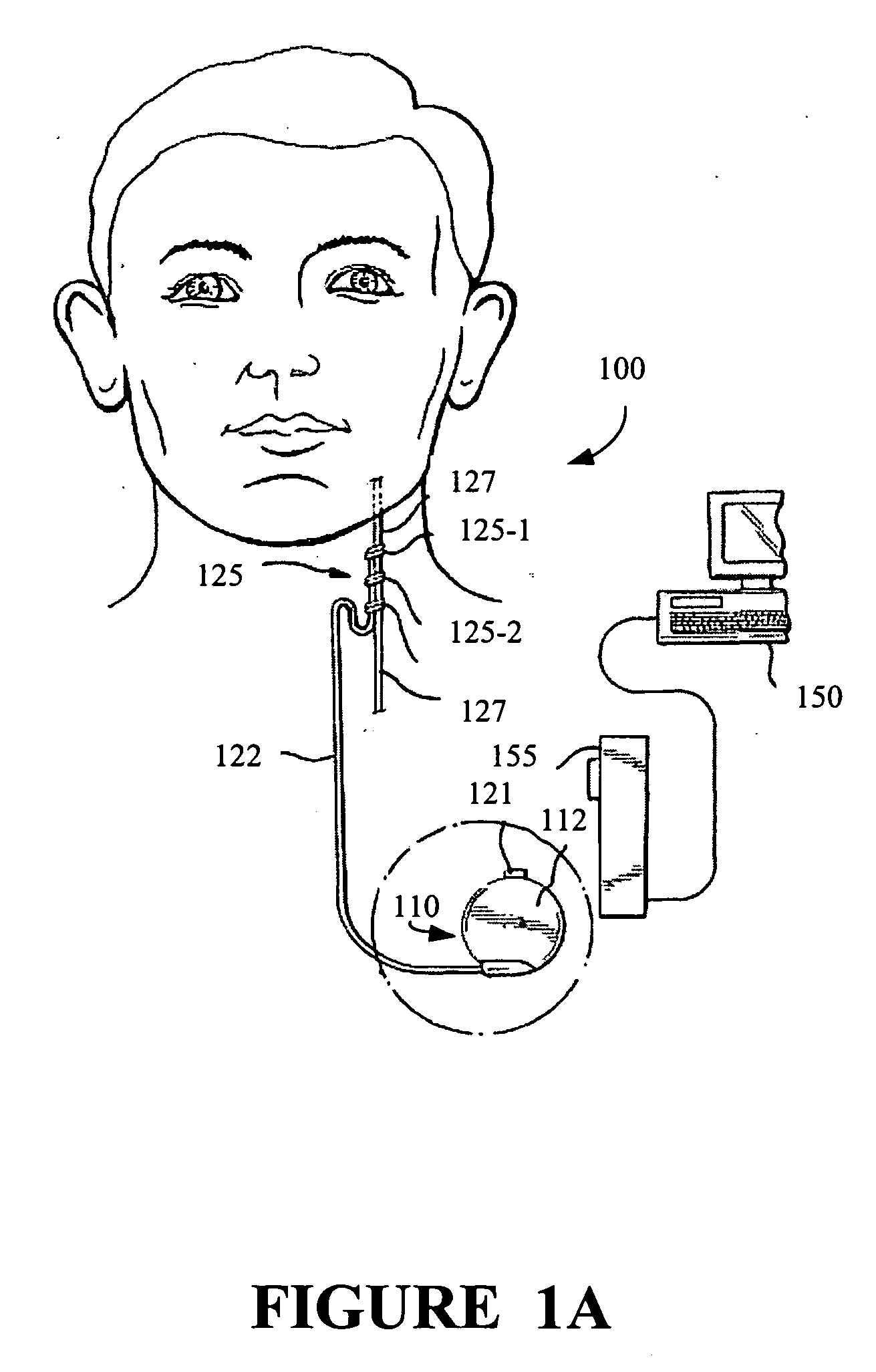 Method and apparatus for forming insulated implantable electrodes
