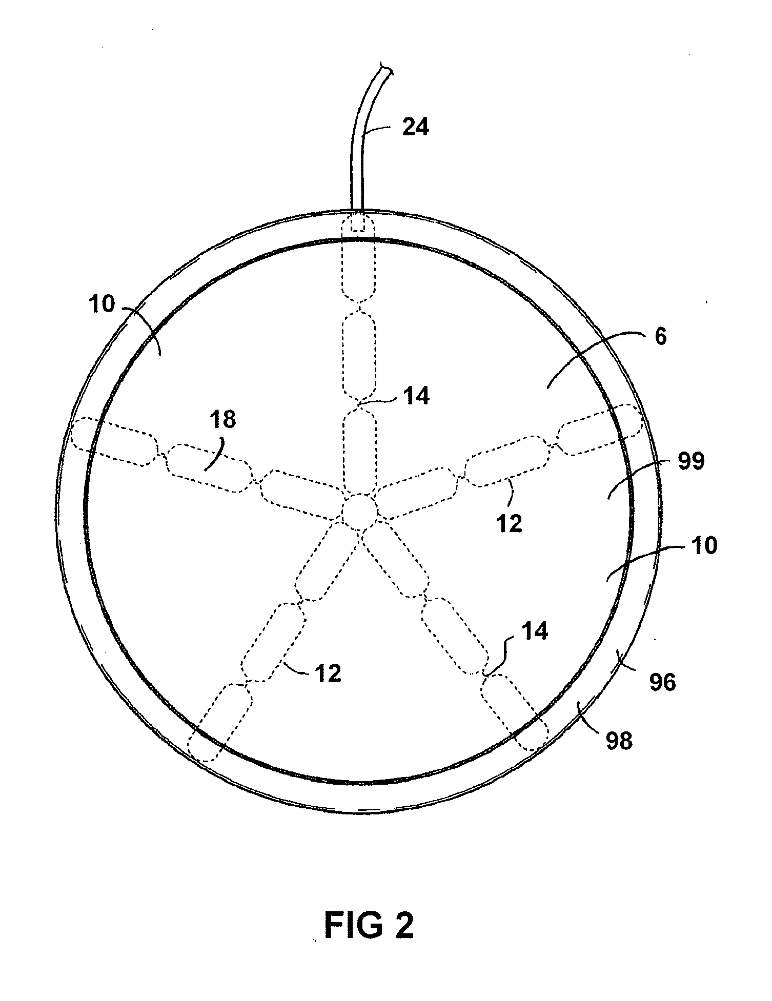 Breast implant with internal flow dampening