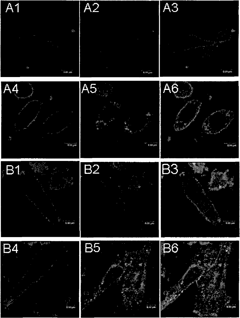 Composite of all-trans-retinoic acid and liposome and application thereof