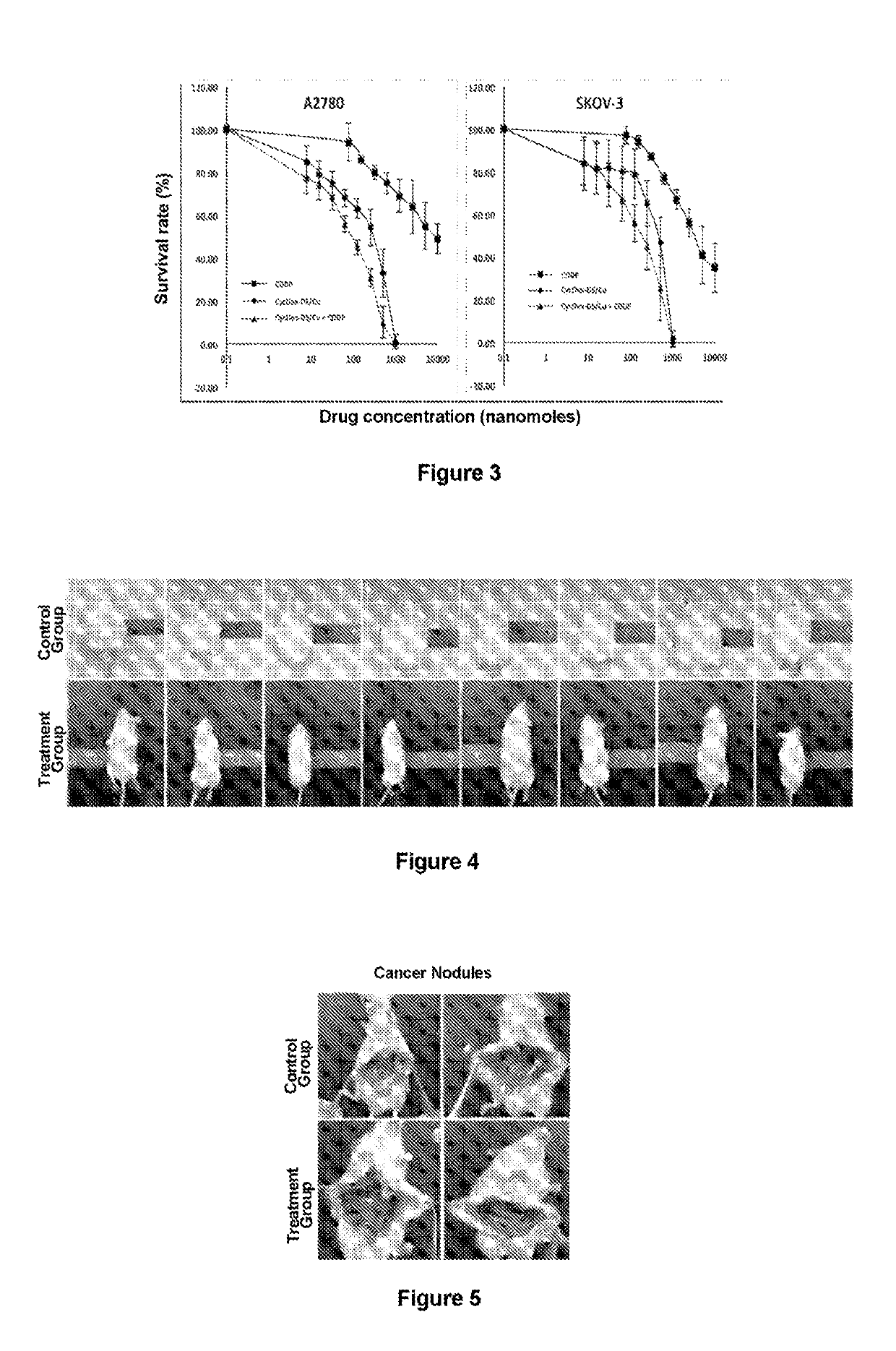 Method for treating pleuroperitoneal membrane cancers by locally injecting disulfiram preparation