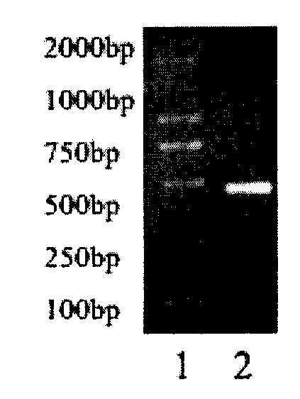 Recombinant EDI (Endothelial Genesis Inhibitor)-8t protein with endothelial cell growth inhibiting activity