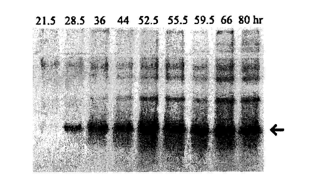 Recombinant EDI (Endothelial Genesis Inhibitor)-8t protein with endothelial cell growth inhibiting activity