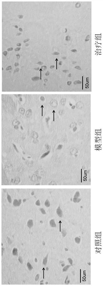 Application of peptide MOTS-c to preparation of medicine for treating Parkinson's disease