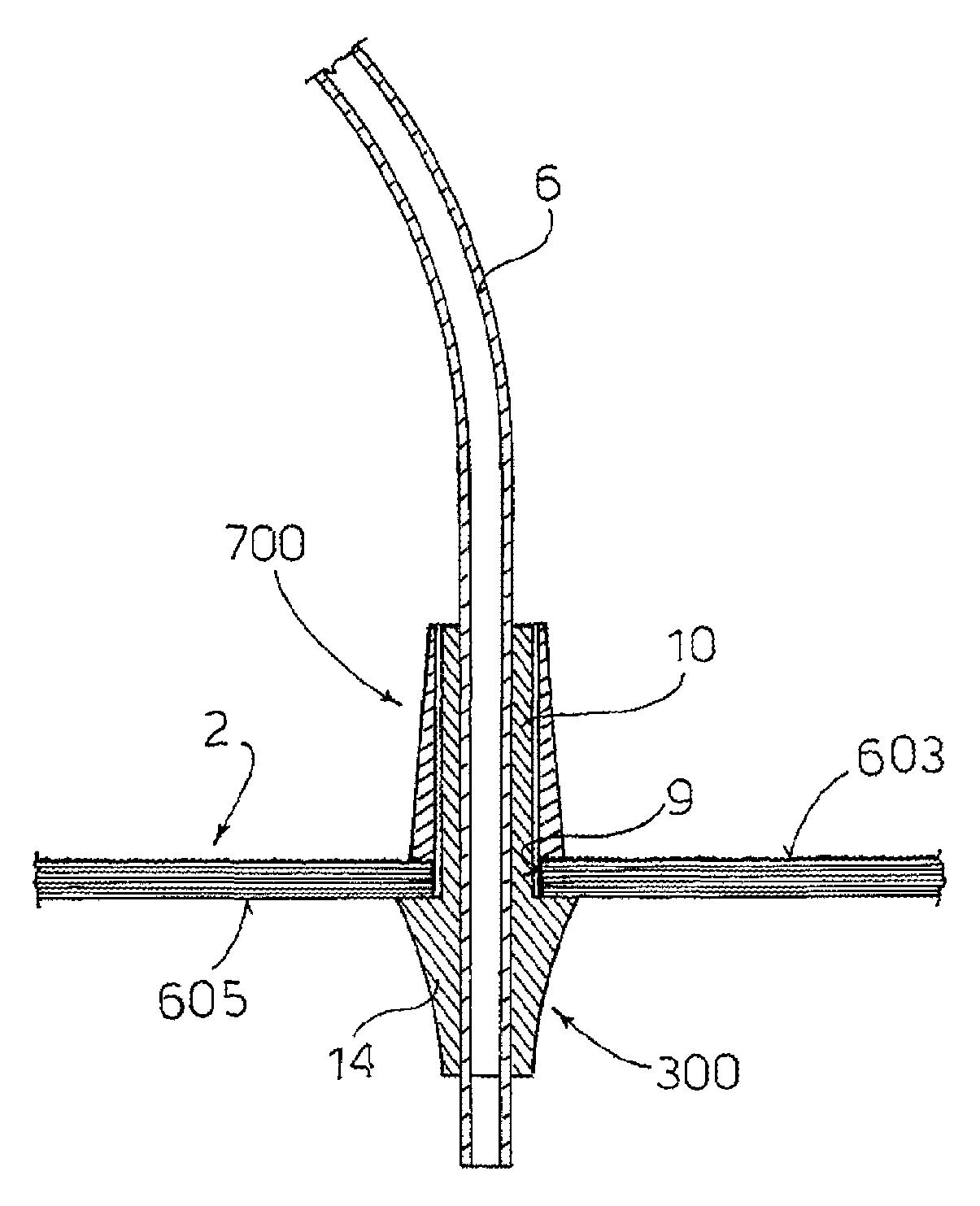 Orthotopic artificial bladder prosthesis