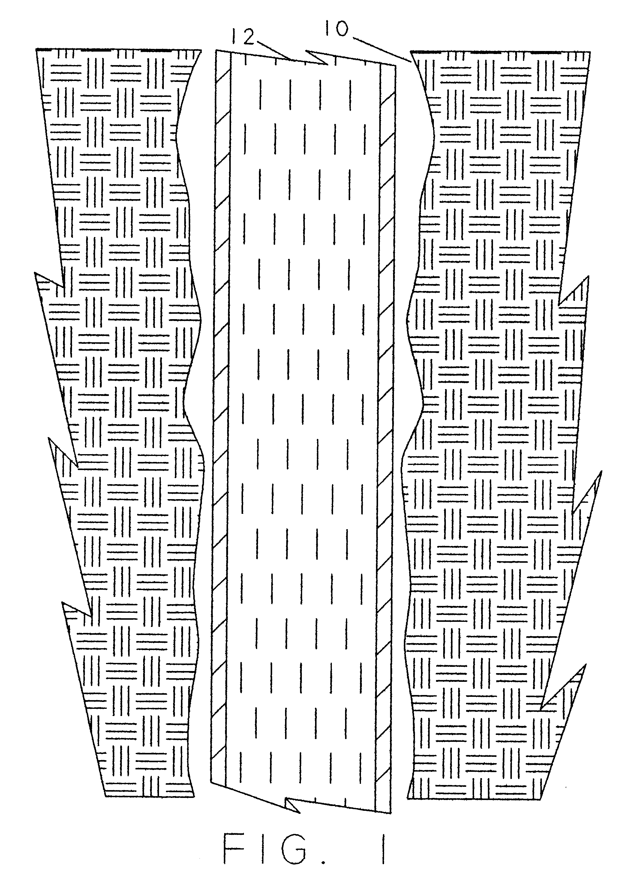 Selective zonal isolation within a slotted liner