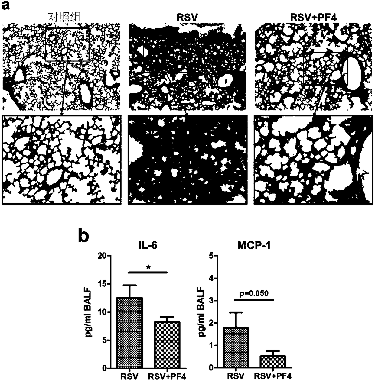 Applications of PF4 in resisting RSV