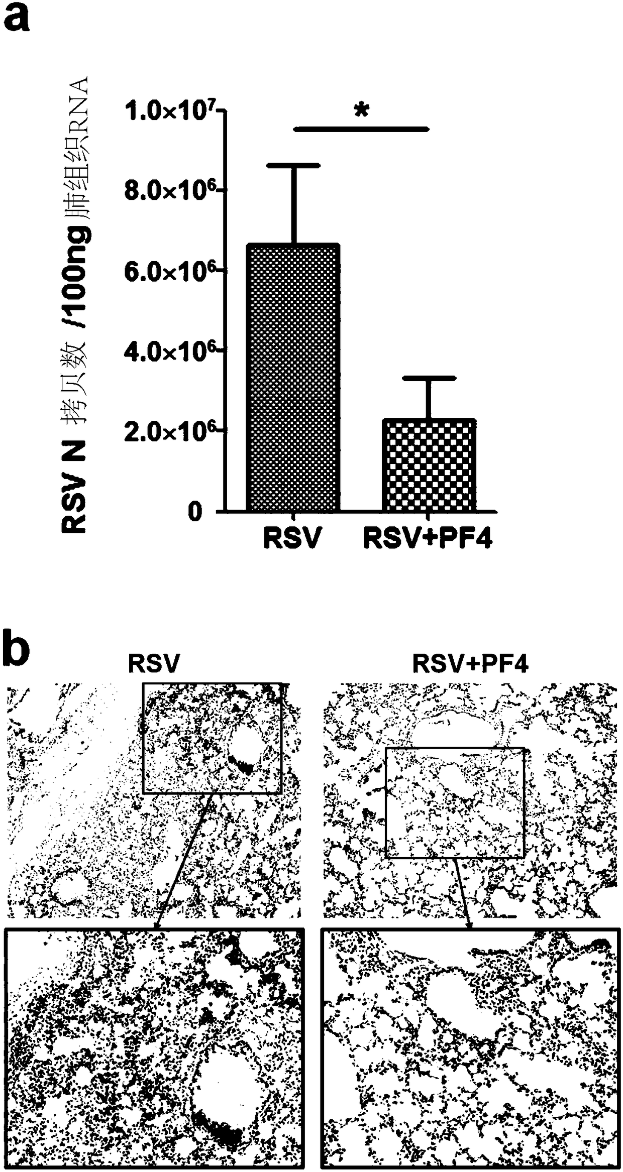 Applications of PF4 in resisting RSV