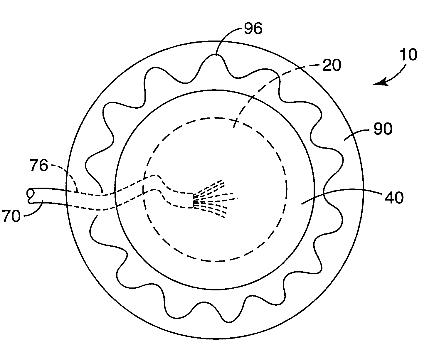 Biomedical electrode with current spreading layer