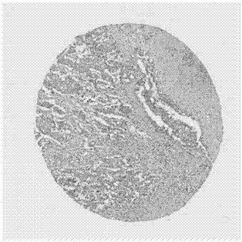 Application of CCBE1 protein to preparation of rectal cancer postoperative prognosis evaluation kit, and kit and method for rectal cancer prognosis evaluation